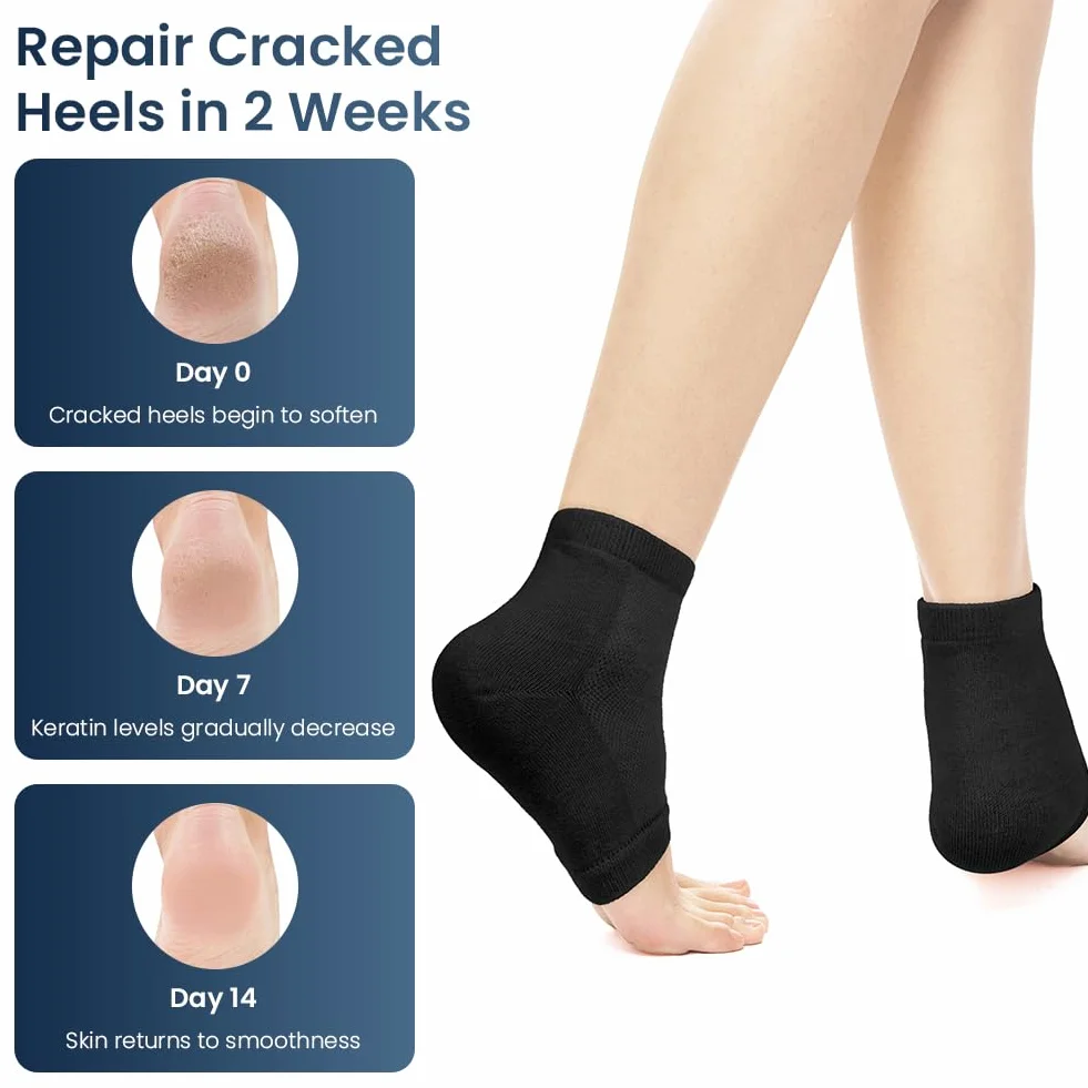 AOOWU Chaussettes Hydratantes Pour Talons, 4 Paires Talon En Gel Ventilé à Bout Ouvert Silicone Souple Pour Pieds Secs