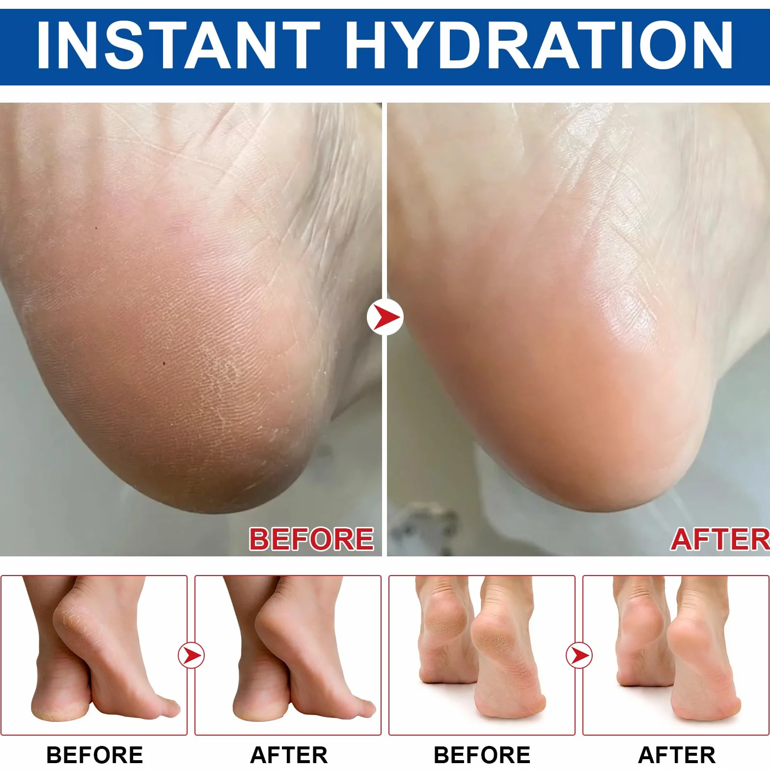 Crème pour pieds à 60% urée et 2% acide salicylique, barre réparatrice talons fissurés, hydratante mains coudes