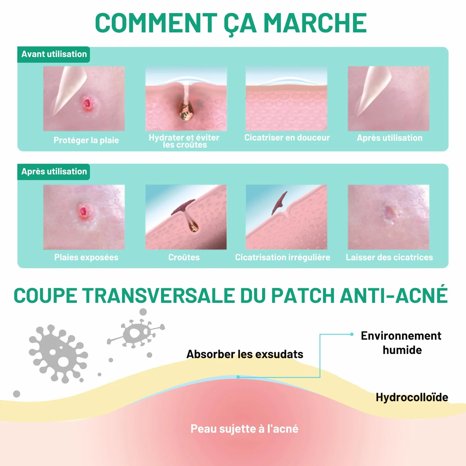 ACOTYE Pimple Patch avec acide salicylique, huile d'arbre à thé et niacinamide, Patchs anti-boutons pour le visage, 210 pièces
