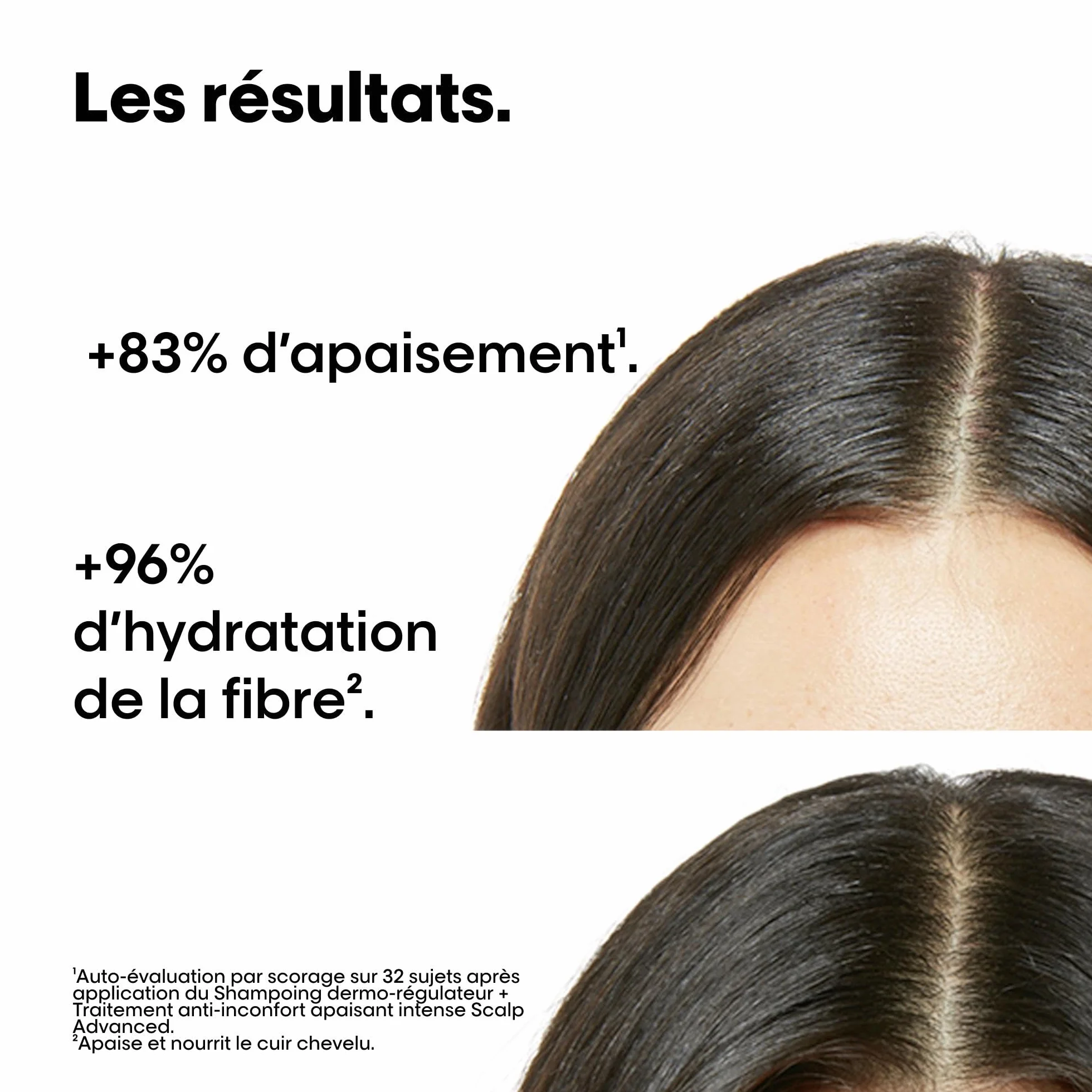 L'Oréal Professionnel Coffret Cadeau Scalp Advanced Routine Anti-Inconfort & Démangeaisons Cuir Chevelu Sensible Duo Shampoing + Traitement à Rincer