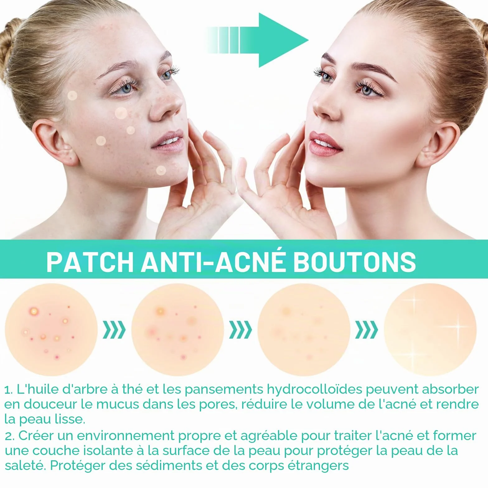 Patch Bouton 200 Patchs – Pimple Patch Invisible Jour & Nuit, Anti-Acné Hydrokolloïde, Sans Parfum, Végan