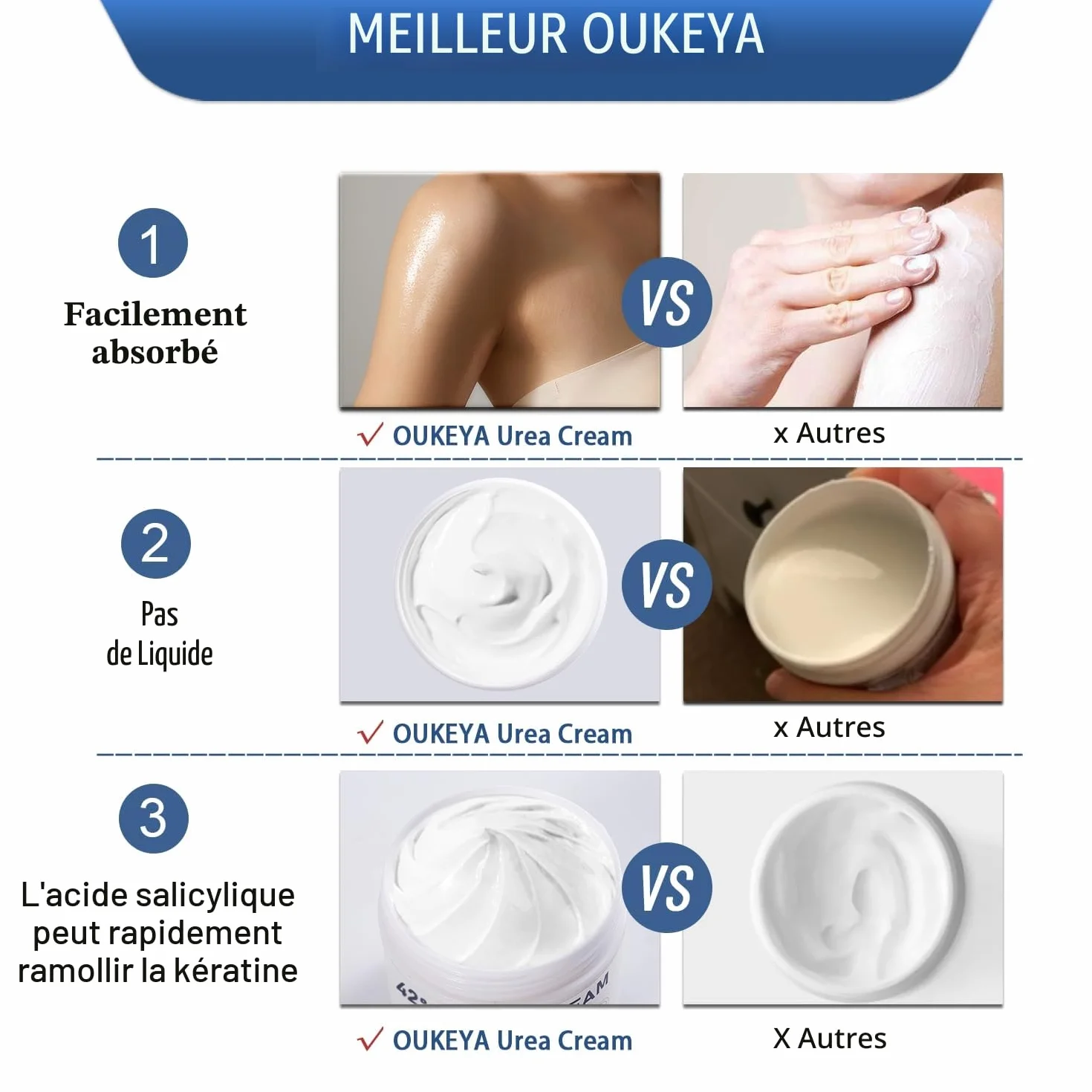OUKEYA Crème d'Uree 42% Acide Salicylique 2% Pieds Mains Très Secs Abîmés Hydratante Réparatrice Intense