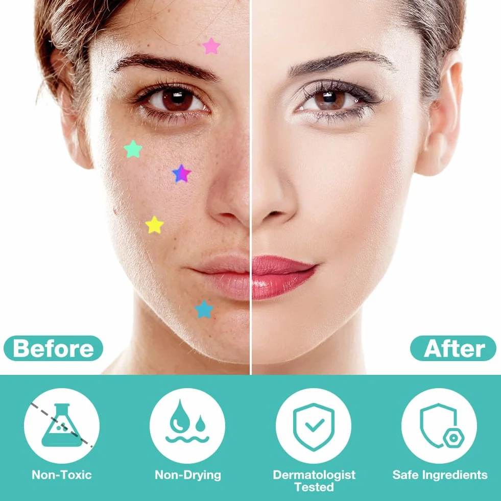 Pimple Patches 400 pièces, Patch Bouton Huile Tea Tree Acide Salicylique Hydrocolloïde Acné Visage