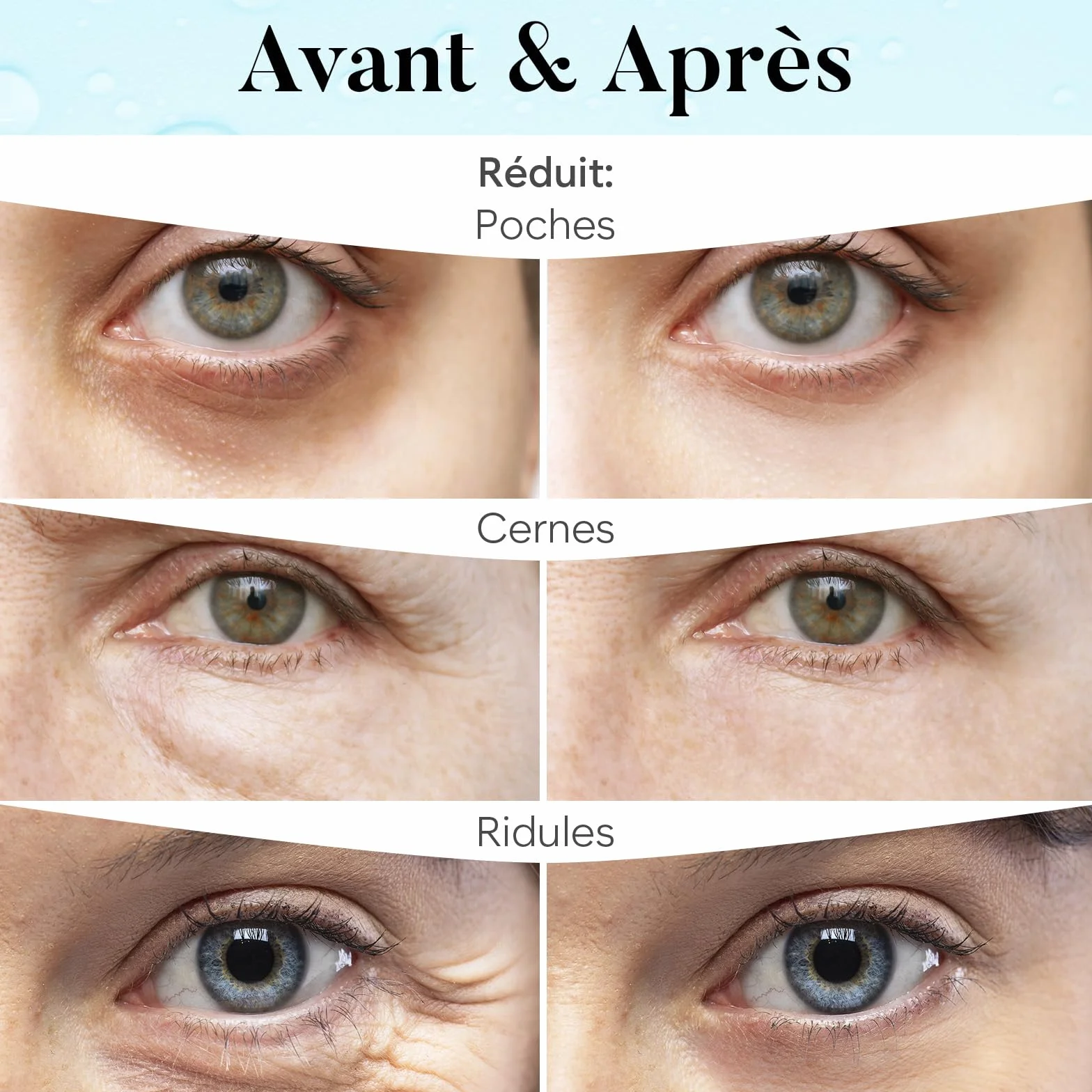BLOOMORA Patch Yeux Anti Cernes avec Rétinol et Collagène, Masque Yeux éclaircissant Hydratation (30 paires)