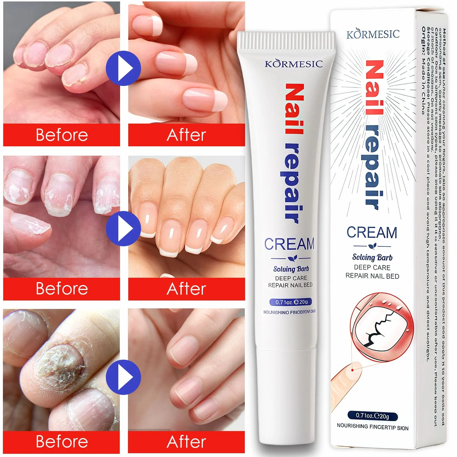 Crème Réparatrice Cuticules 2×20g Soin Profond Hydratant Apaisant Ongles