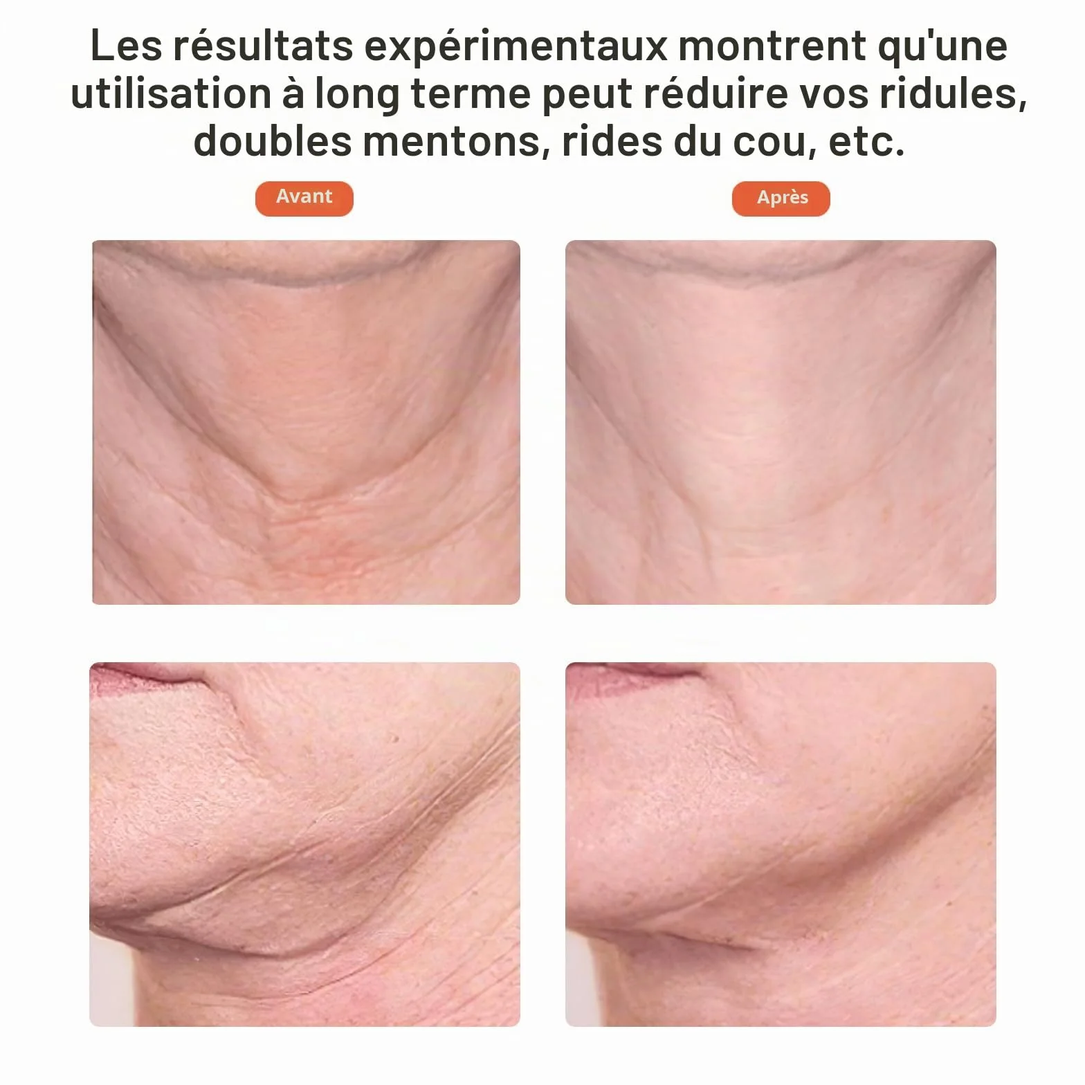 Ms.W Appareil Anti-Rides et Lifting Visage, Massage et Soin Anti-âge, Tonification et Raffermissement du Cou, Réduction des Pores, Rechargeable
