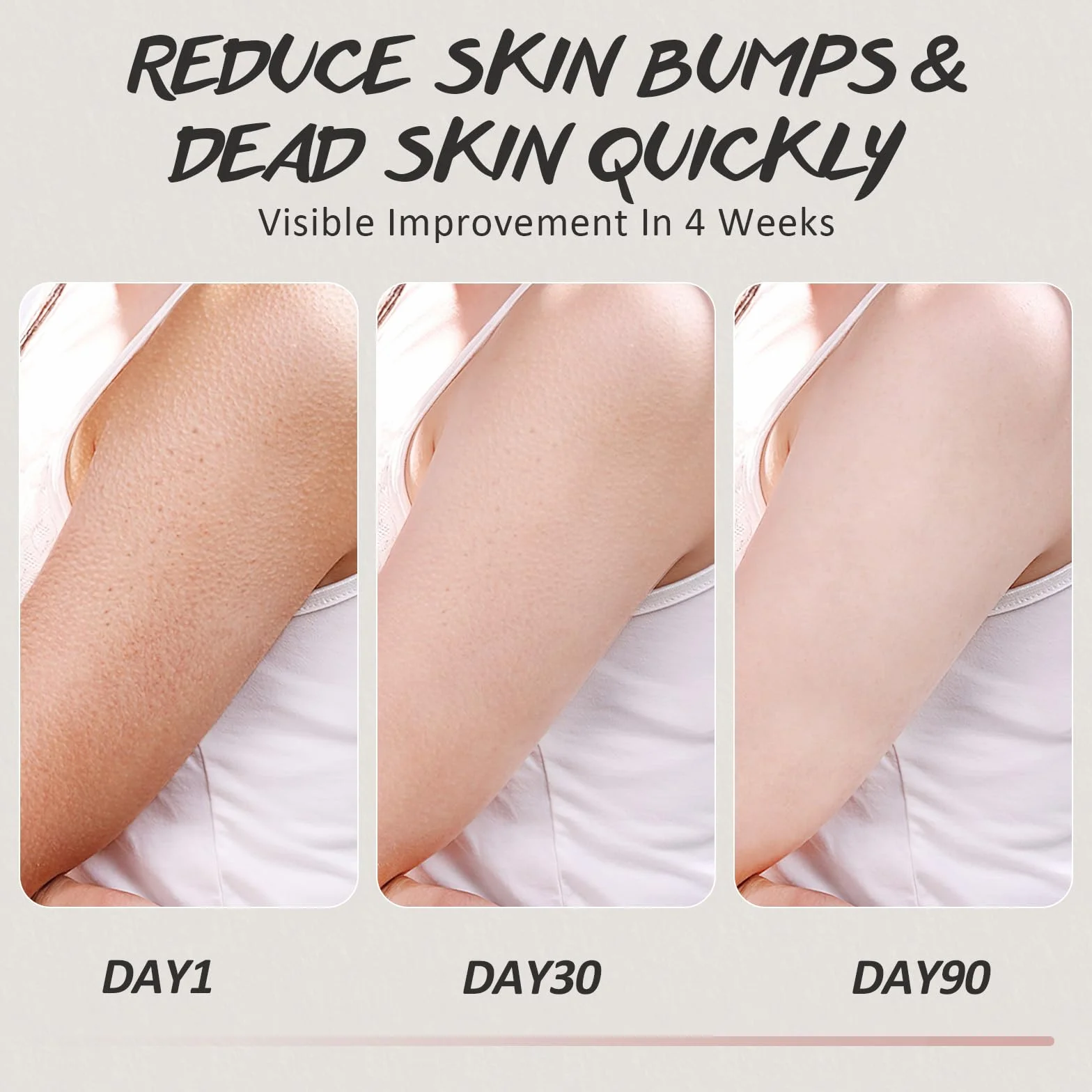 Gommage Corporel Kp Bump Eraser pour Kératose Pilaire Jambes à la Fraise Acide Salicylique AHA Exfoliant Corporel Kp Peau de Poulet