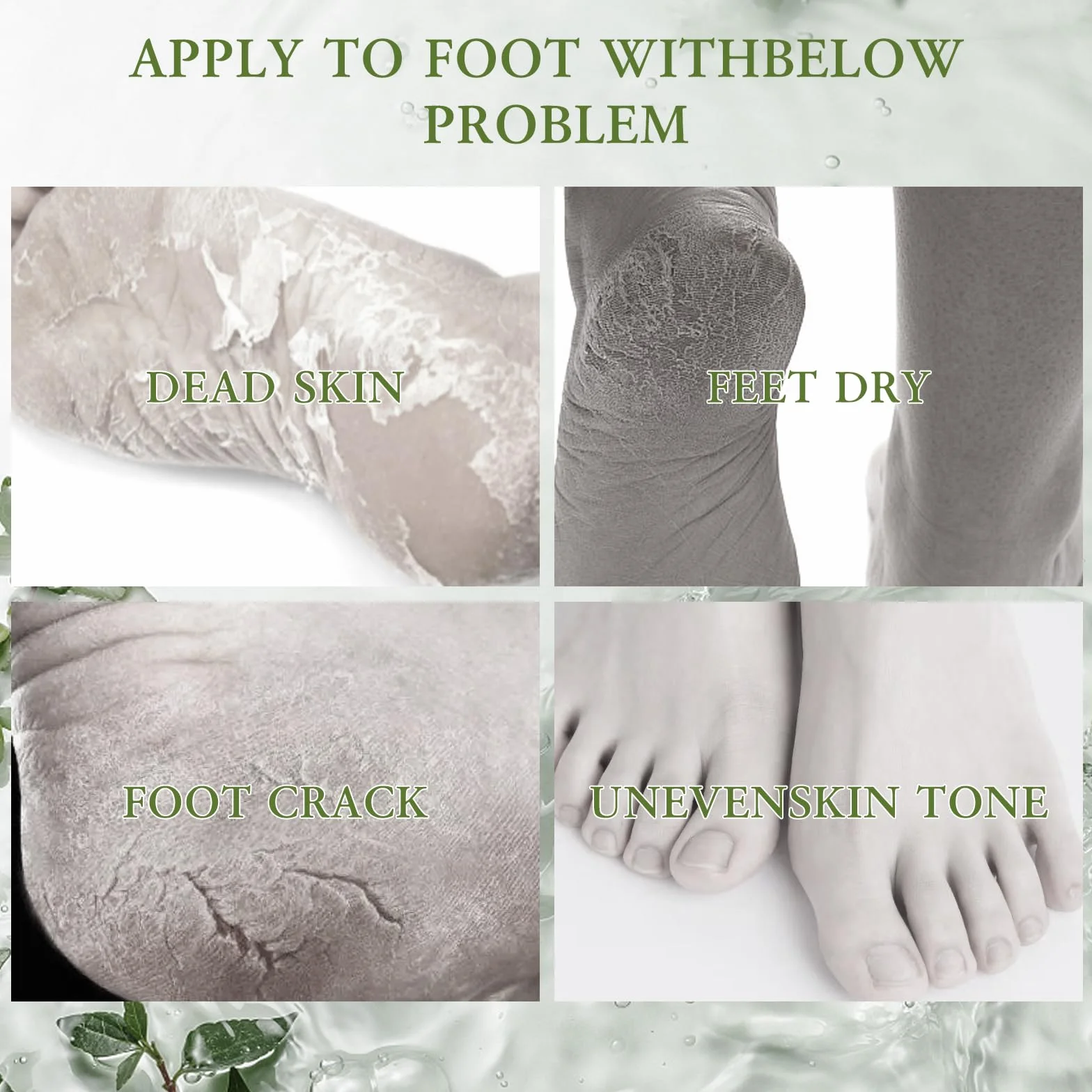 Chaussettes anti-callosités à l'aloe vera Lot de 6 paires - Soin hydratant pieds secs fissurés