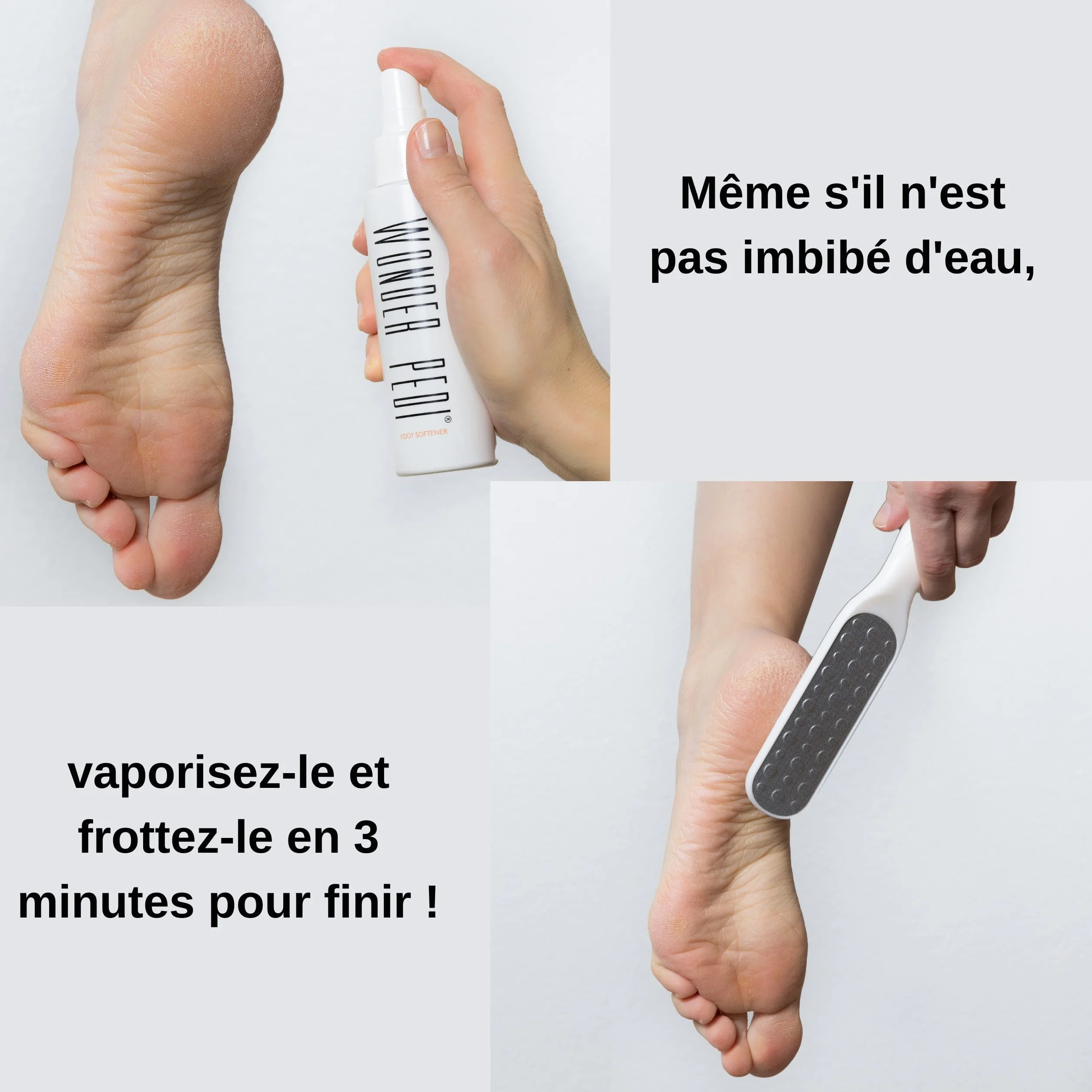 Détachant les callosités - Fixation rapide en trois minutes - Râpe pour les pieds - Exfoliant instantané pour les pieds - Spray exfoliant instantané - Lime à récurer les callosités - Traitement de