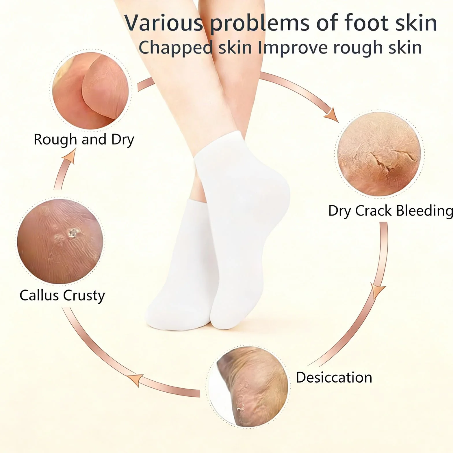 VolksRose Masque Pieds et Mains en Silicone Antidérapants Hydratants avec Peeling pour Callosités - Soin Réutilisable