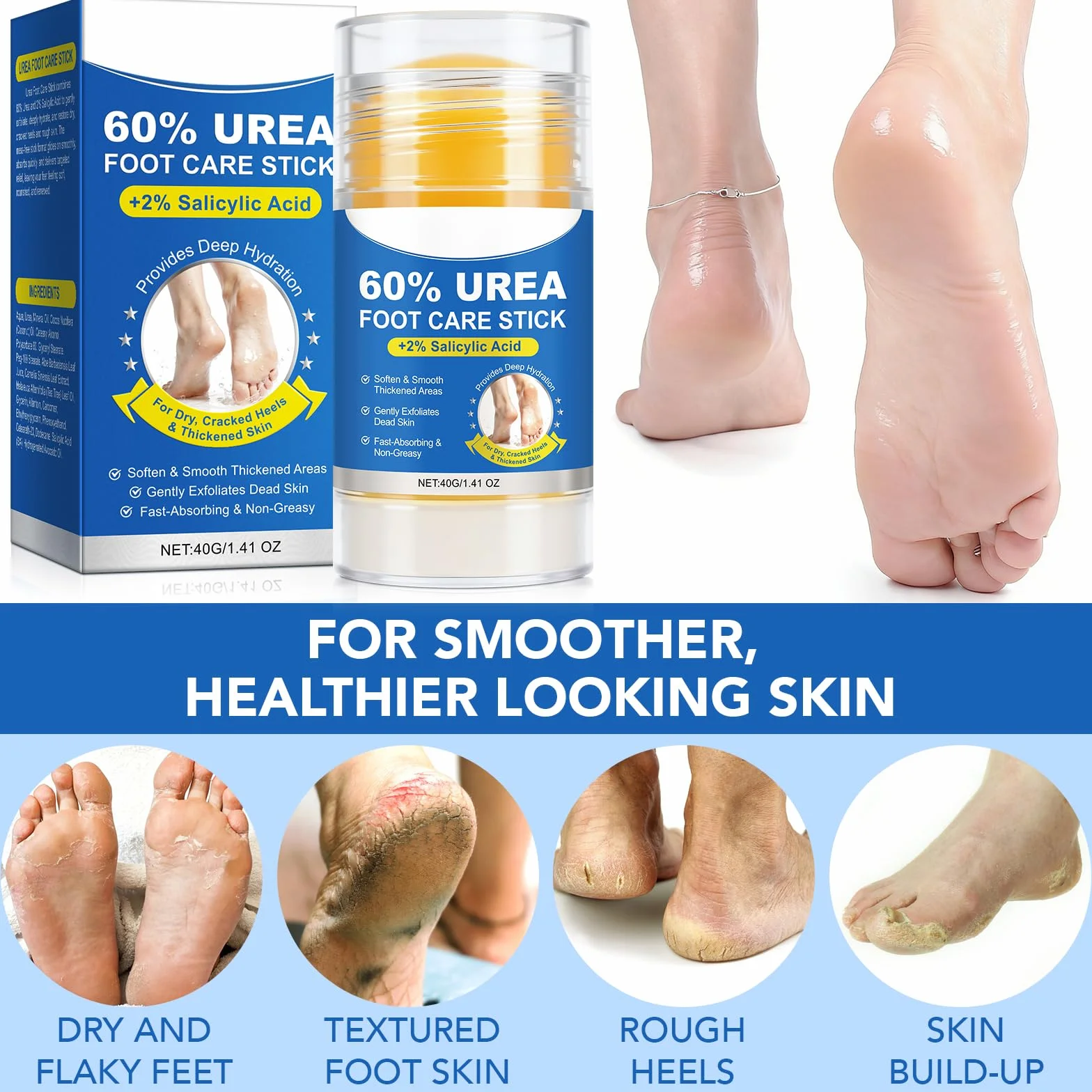 Crème pour les pieds 60% urée + 2% acide salicylique éliminateur de callosités exfoliant hydratant talons gercés (1 Pack)