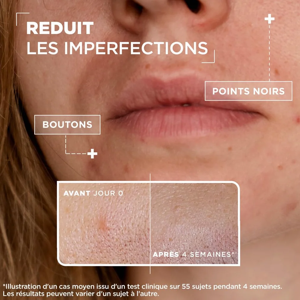 Mixa Sérum Concentré Anti-Imperfections Visage Niacinamide Acide Salicylique 30ml