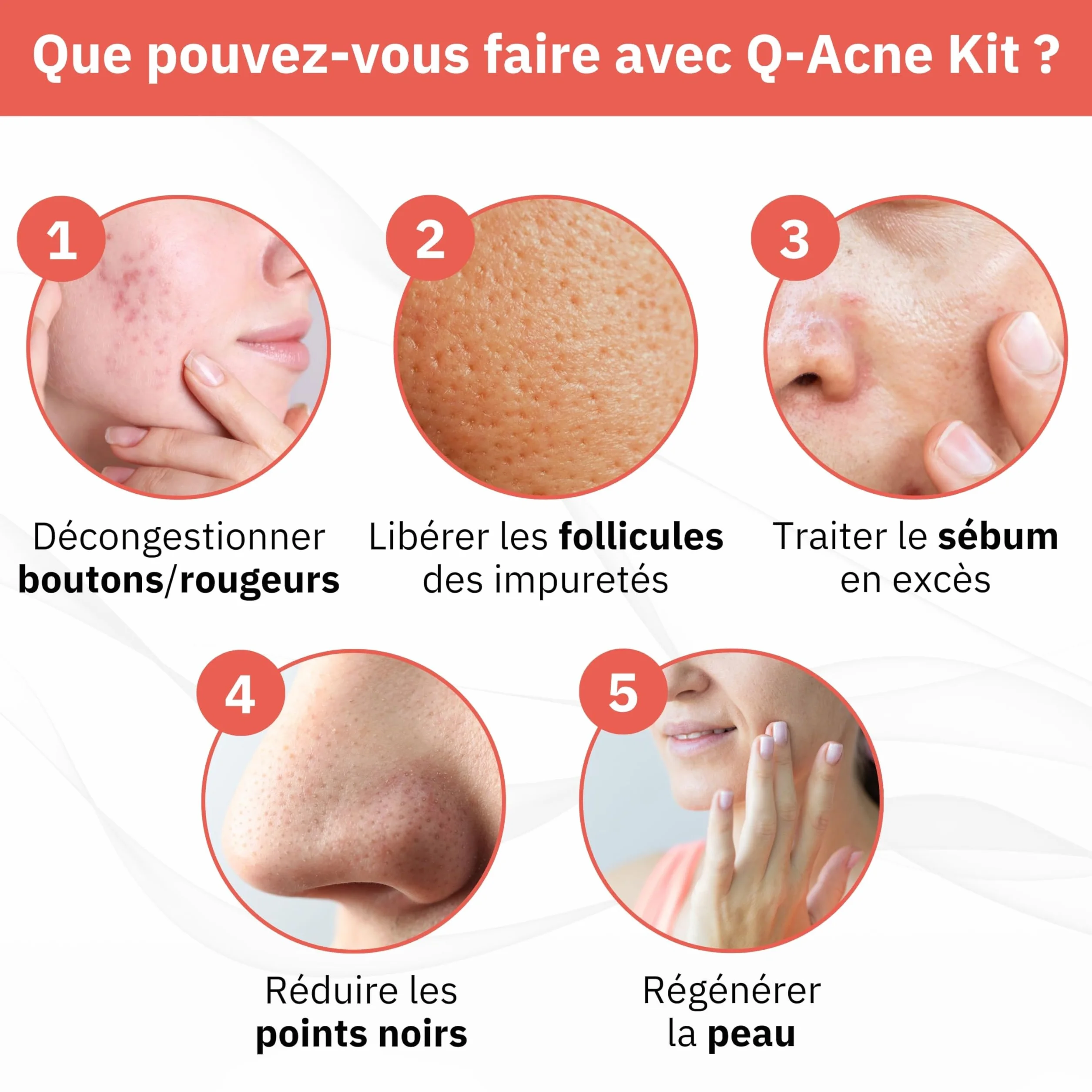 Q1 Q-Acne Complex, Crème Anti Acné à l'Acide Salicylique, Crème Anti Boutons pour le Visage | Elimine les Boutons et les Rougeurs | Traitement Efficace pour l'Acné Juvénile et Hormonale, 40ml