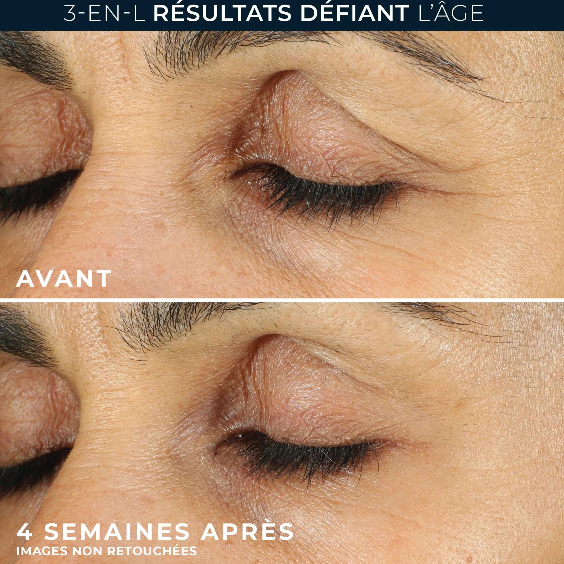 RoC Retinol Correxion Soin Lissant Crème Contour des Yeux Anti-Rides 15 ml