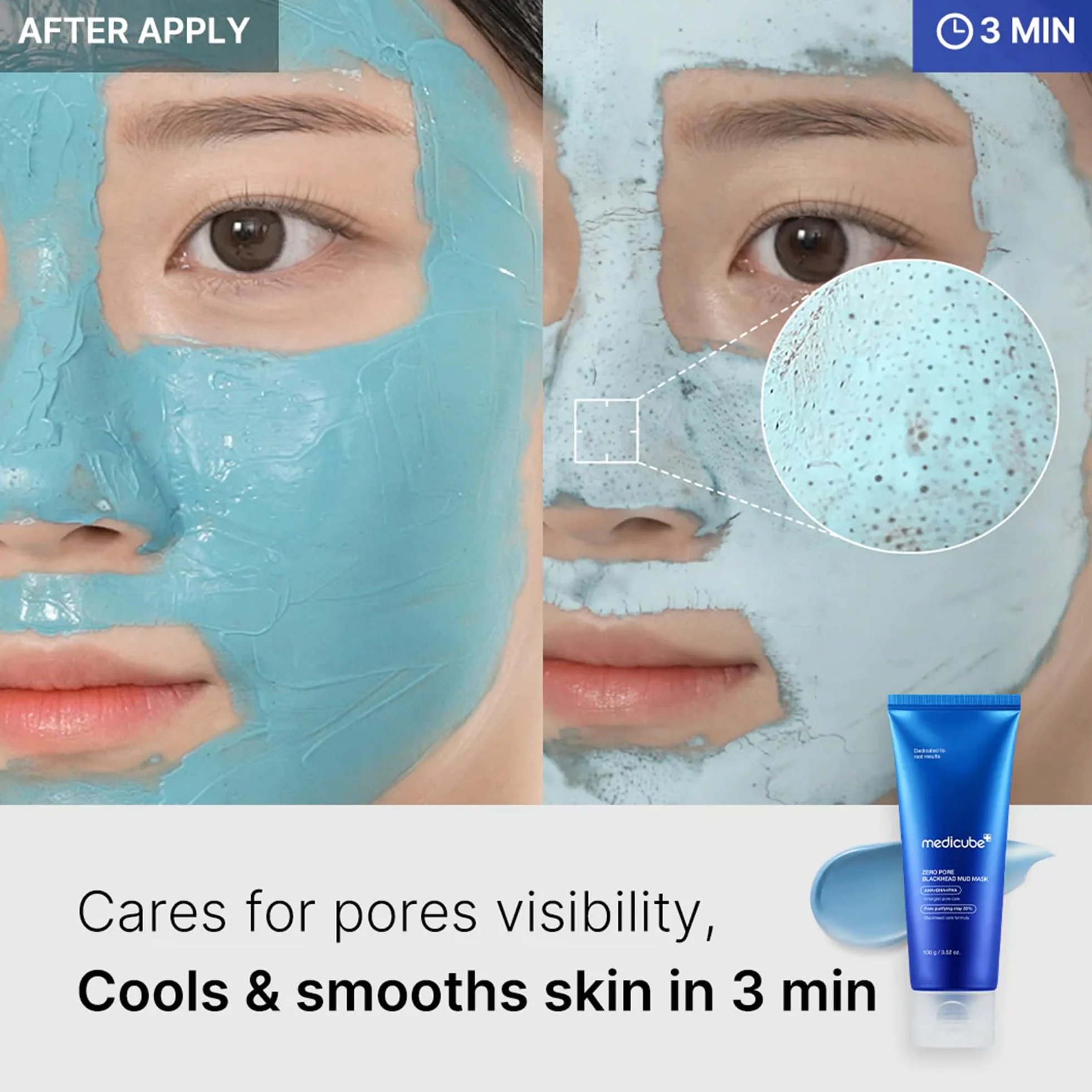 Medicube Zero Pore Blackhead Mud Mask 3.52 oz AHA BHA PHA