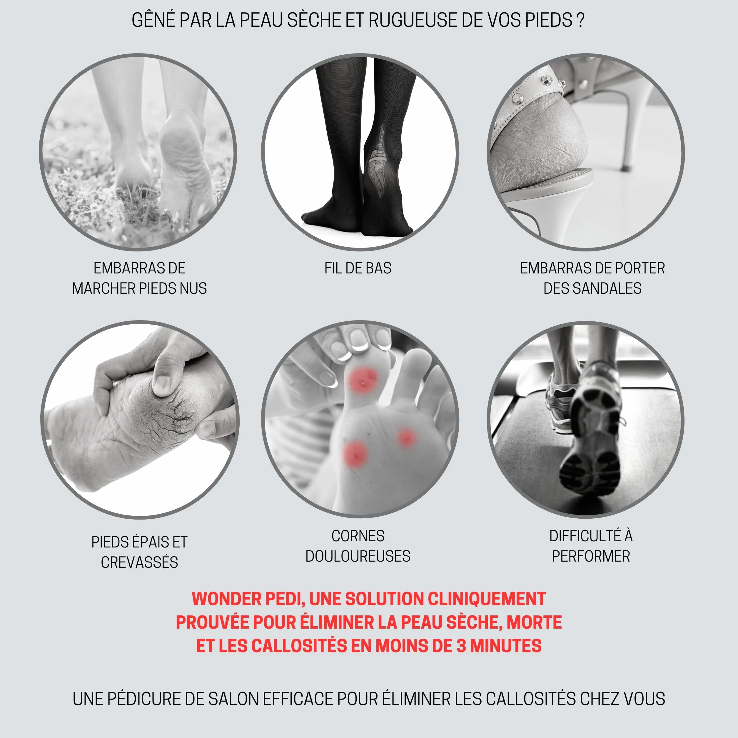 Détachant les callosités - Fixation rapide en trois minutes - Râpe pour les pieds - Exfoliant instantané pour les pieds - Spray exfoliant instantané - Lime à récurer les callosités - Traitement de