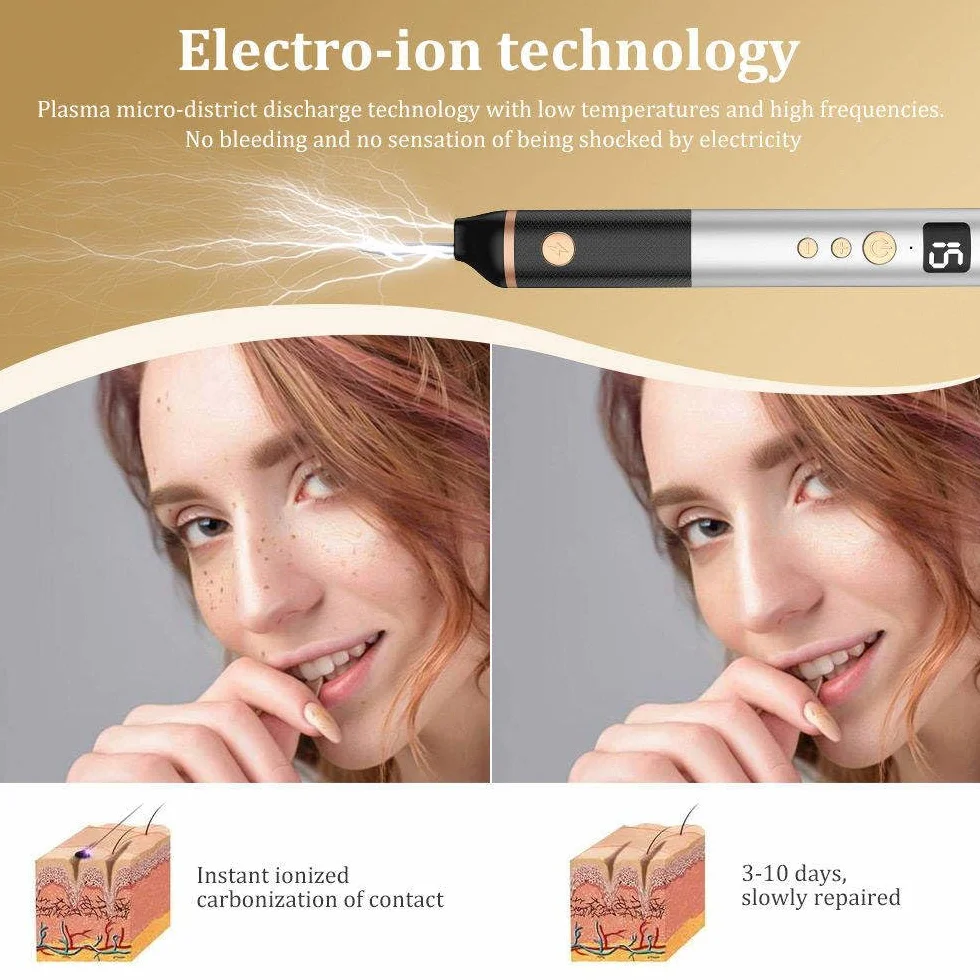 Stylo Laser Plasma à 15 Niveaux Pour L'élimination Des Verrues,Grains De Beauté,Taches,Taches De Rousseur Et Nævus Sur Les Lèvres,Les Mains,Les Yeux,Le Visage,La Tête Et Le Nez, Sûr Et Indolore