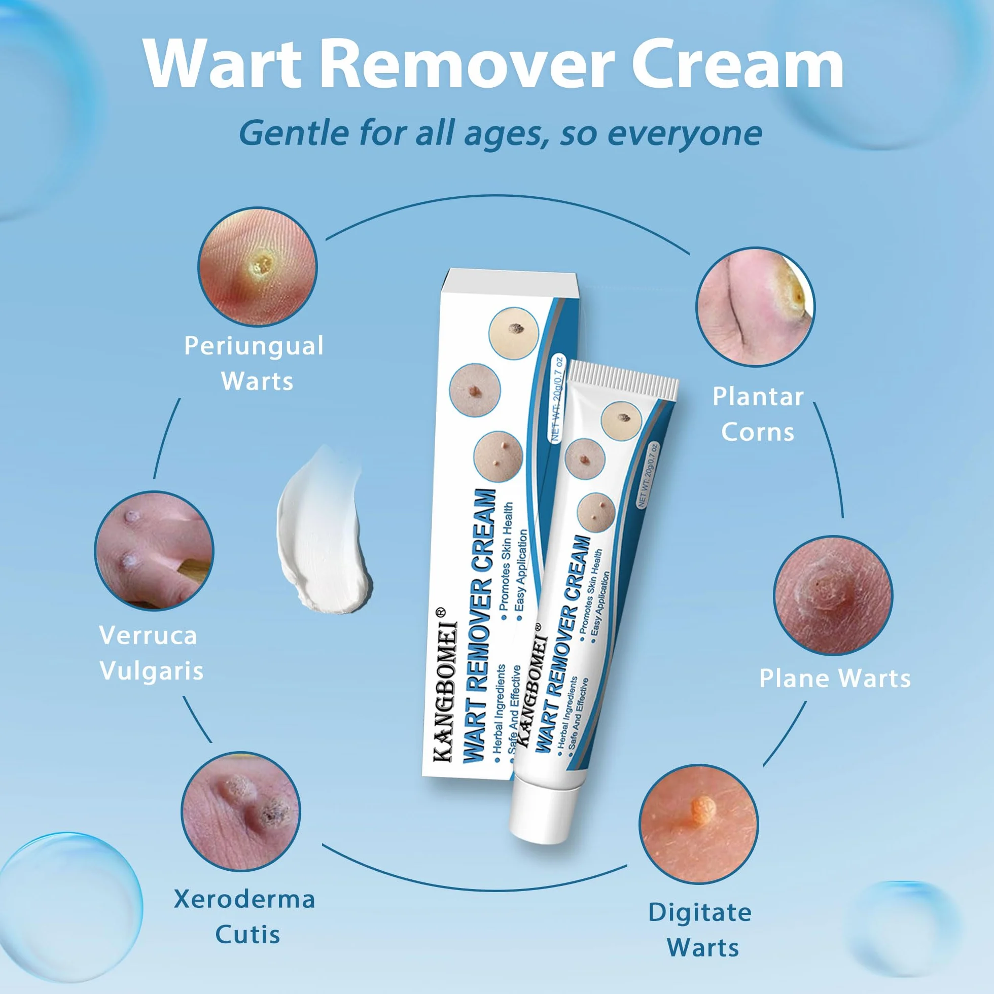 Crème anti-verrues kit d'élimination des acrochordons 20g