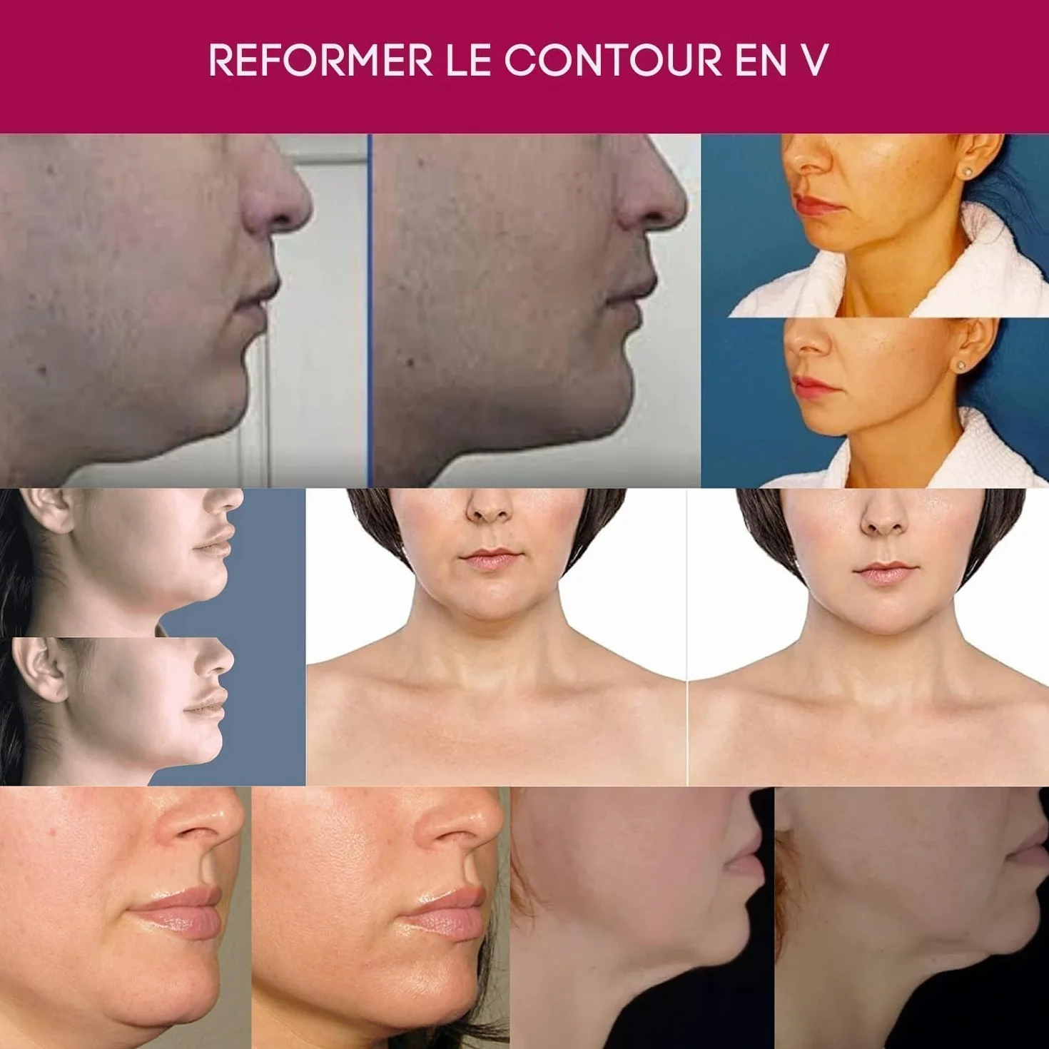 Crème pour le cou avancée - Crème anti-âge pour le cou, le menton et la mâchoire pour femmes et hommes 30 ml