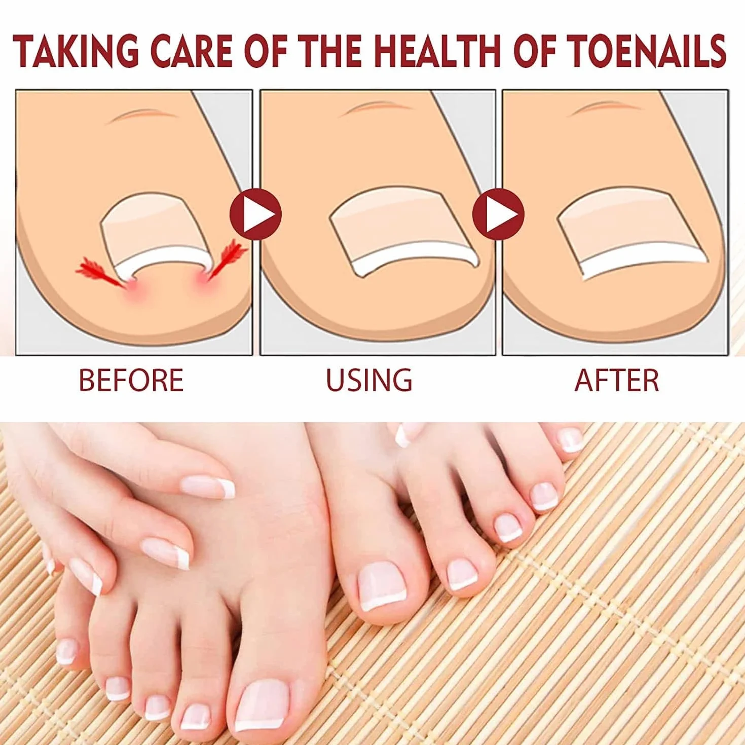 German Toenailplus Anti Paronychia Relief Oil, Paronychia Treatment for Toe and Fingernail Repair (2pcs)