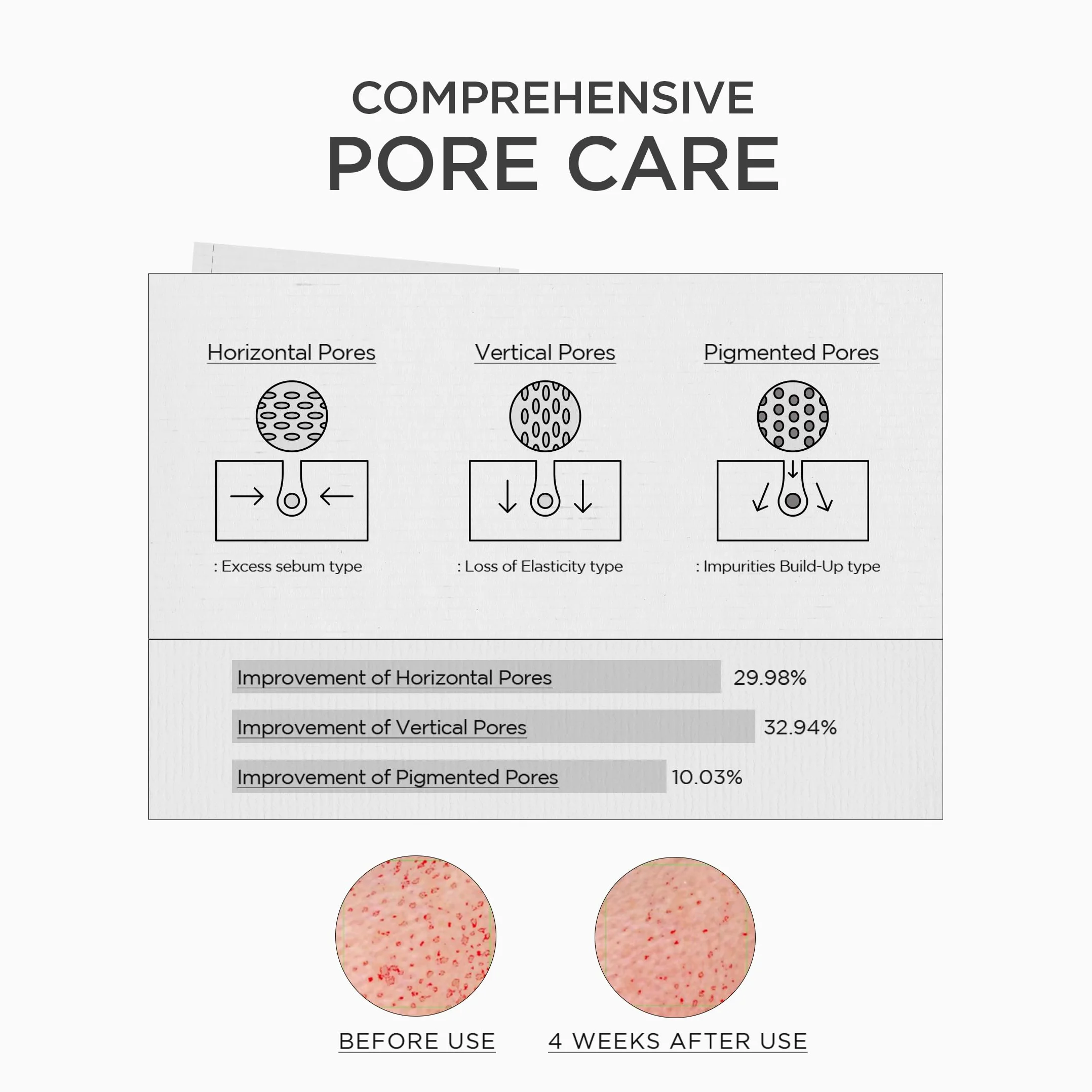 SKIN1004 Madagascar Centella Niacinamide 10% Boosting Shot Bulbe, 30 ml