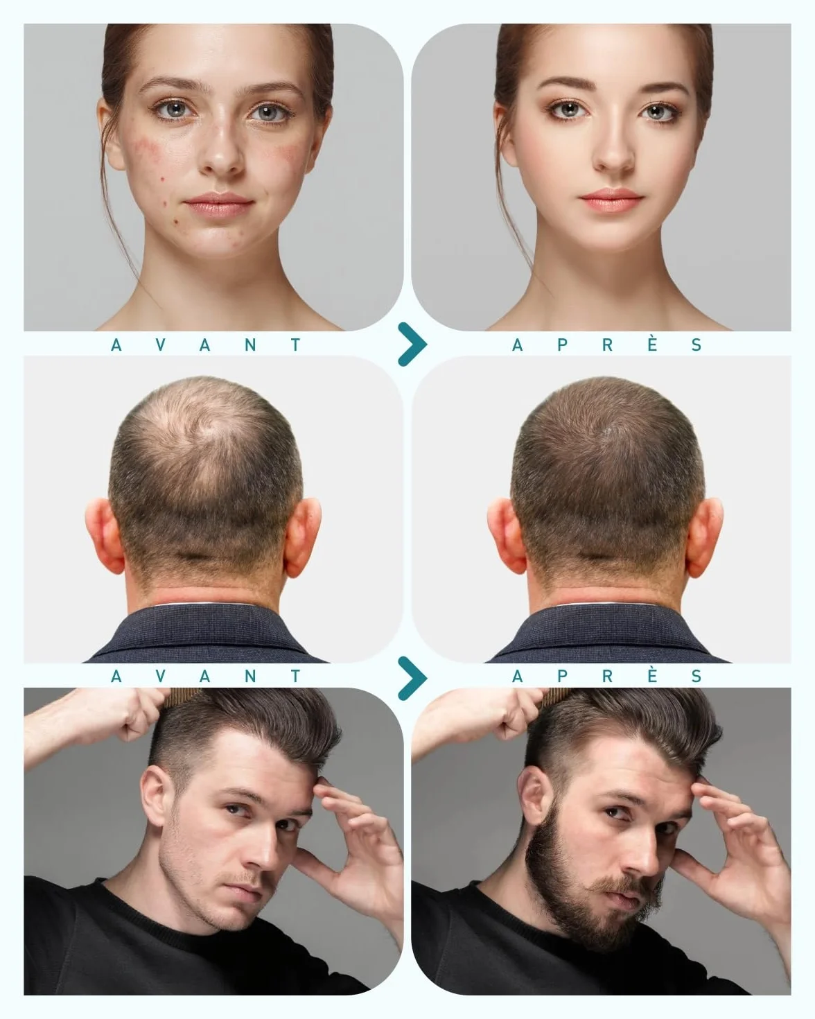 Derma Roller 0.5 mm, Kit Microneedling 10 in 1 pour le soin/massage/nettoyage de la peau, rouleau à barbe 720 aiguilles en titane, Pour les rides, les pores dilatés, les rides et les cicatrices G10