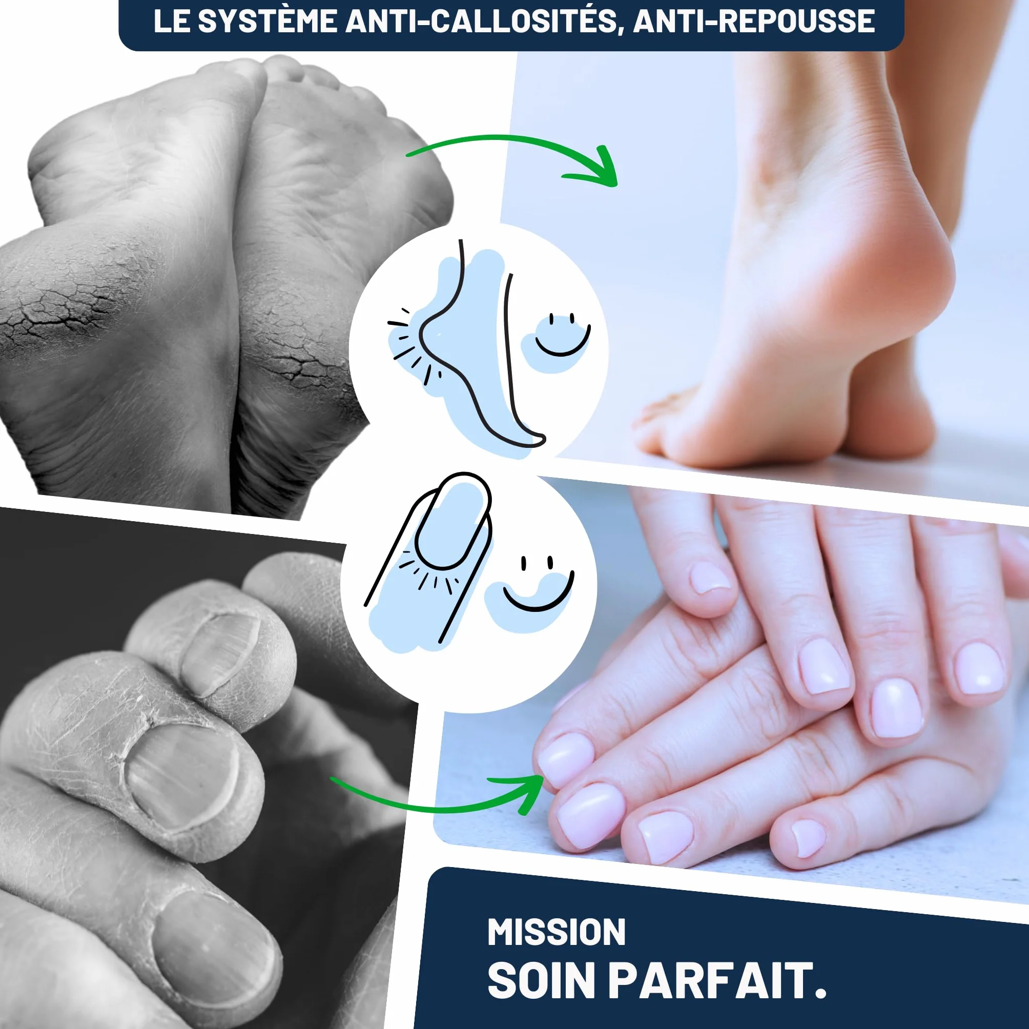 Mr. Fuss No. 1 Plus Pack Petits cuticules Lot économique 4 pièces Solution active 250 ml Ouate Couverts
