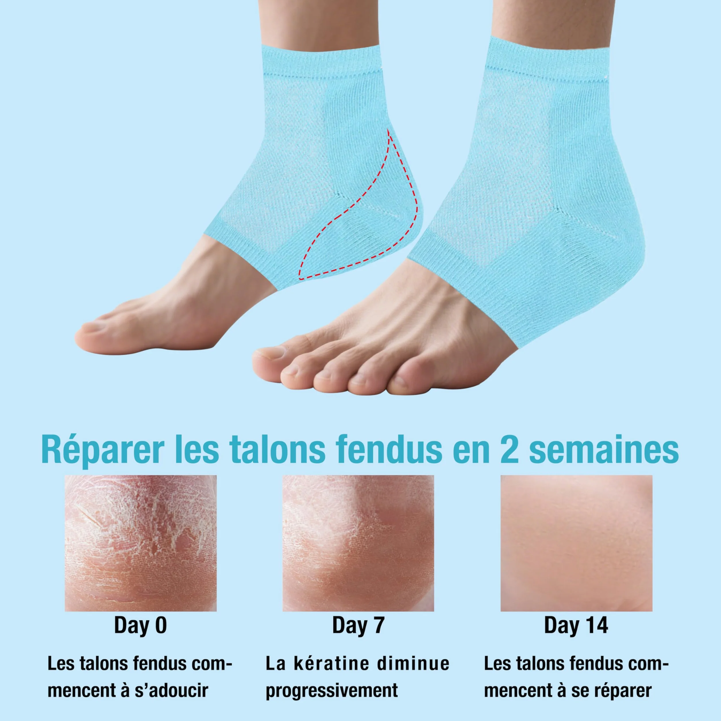 Chaussettes hydratantes de nuit réutilisables en gel respirant silicone souple pour pieds secs crevassés