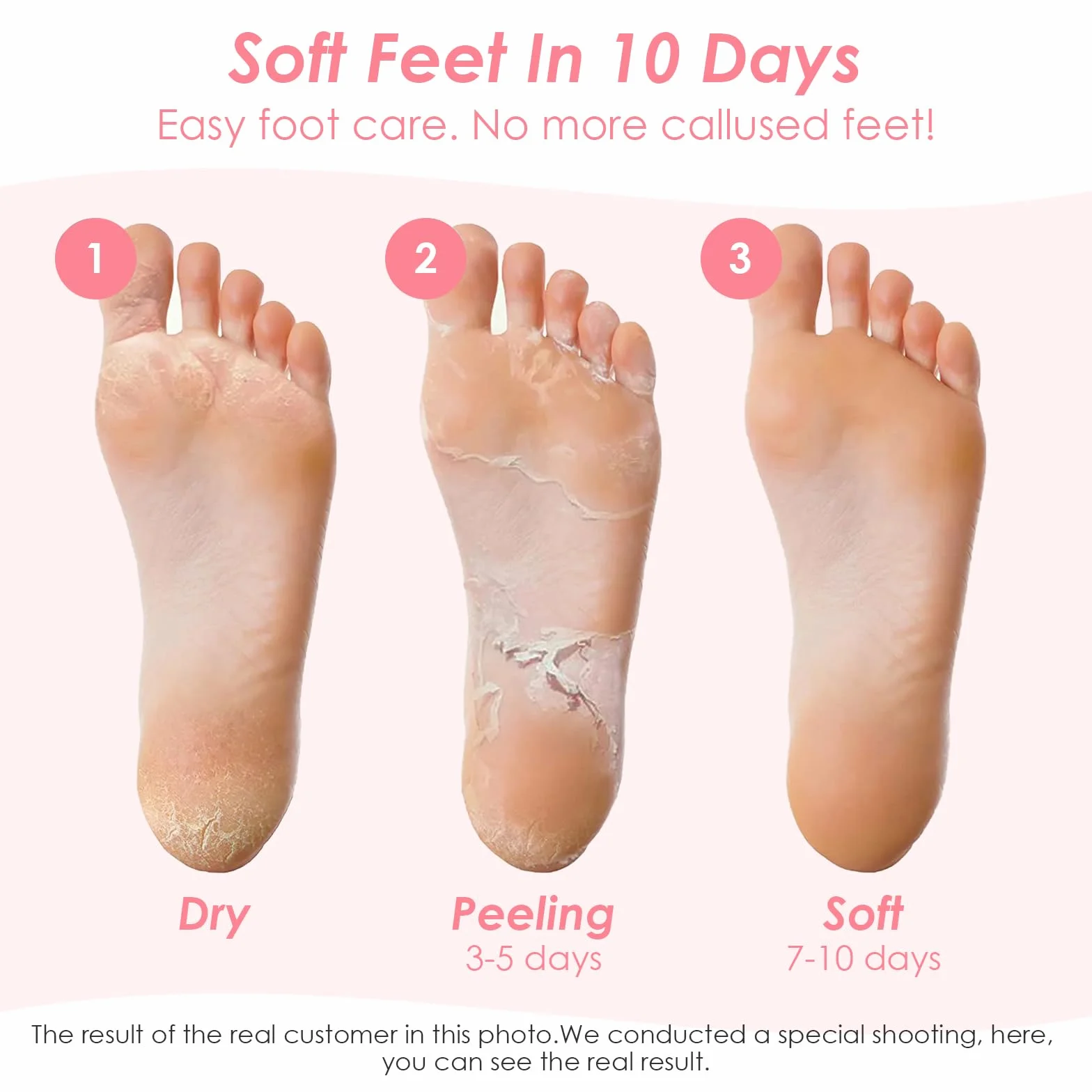 Masque Pieds Peeling Exfoliant pour Femmes & Hommes, Fraise Pêche