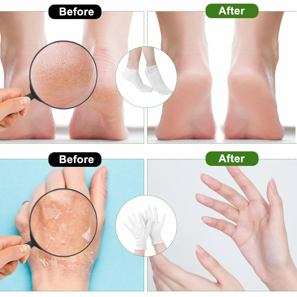 Gants Hydratants et Chaussettes Hydratantes Réutilisables en Coton Blanc pour Femme Eczéma Soins des Mains