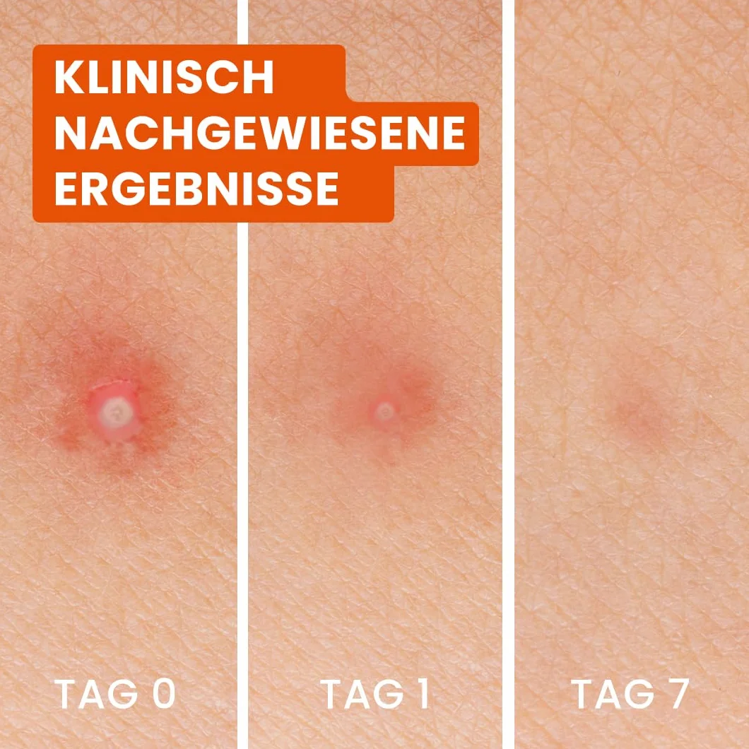 Bioré Patch 3 en 1 Anti-Boutons x24