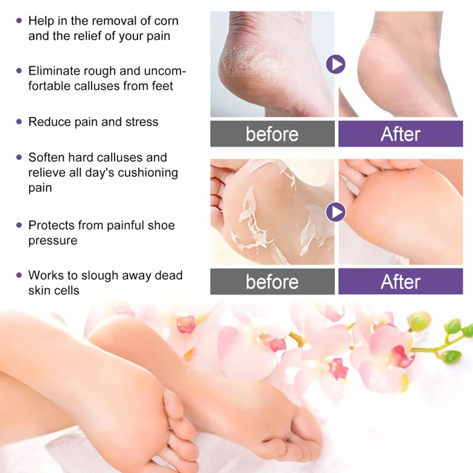 Masque Pied Peeling 5 Paires | Chaussette Exfoliante Pieds Secs Abîmés | Gommage Callus Soin Peau Morte