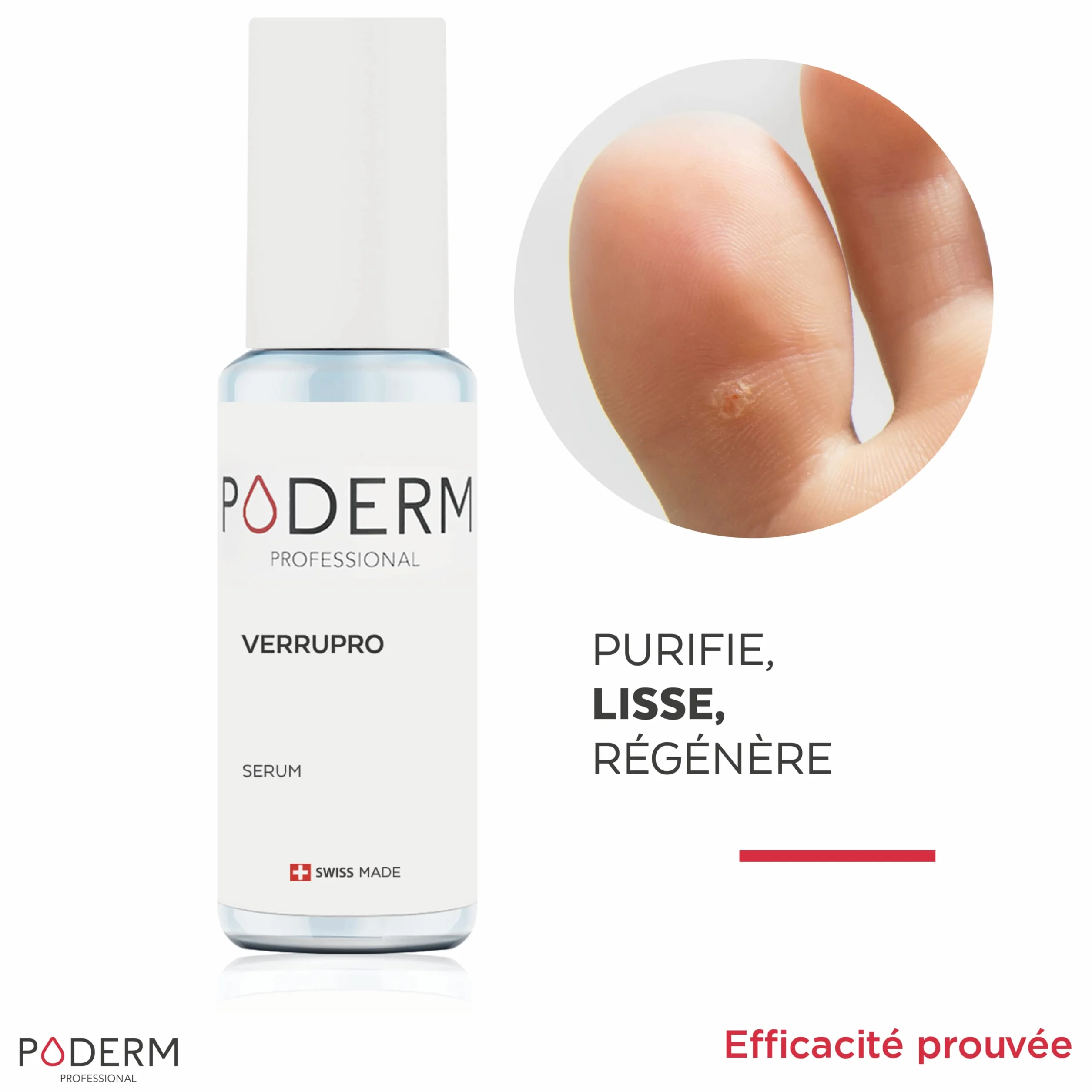 PODERM VERRUPRO SOLUTION PIEDS-MAINS Huile Sérum 100% Naturels Swiss Made