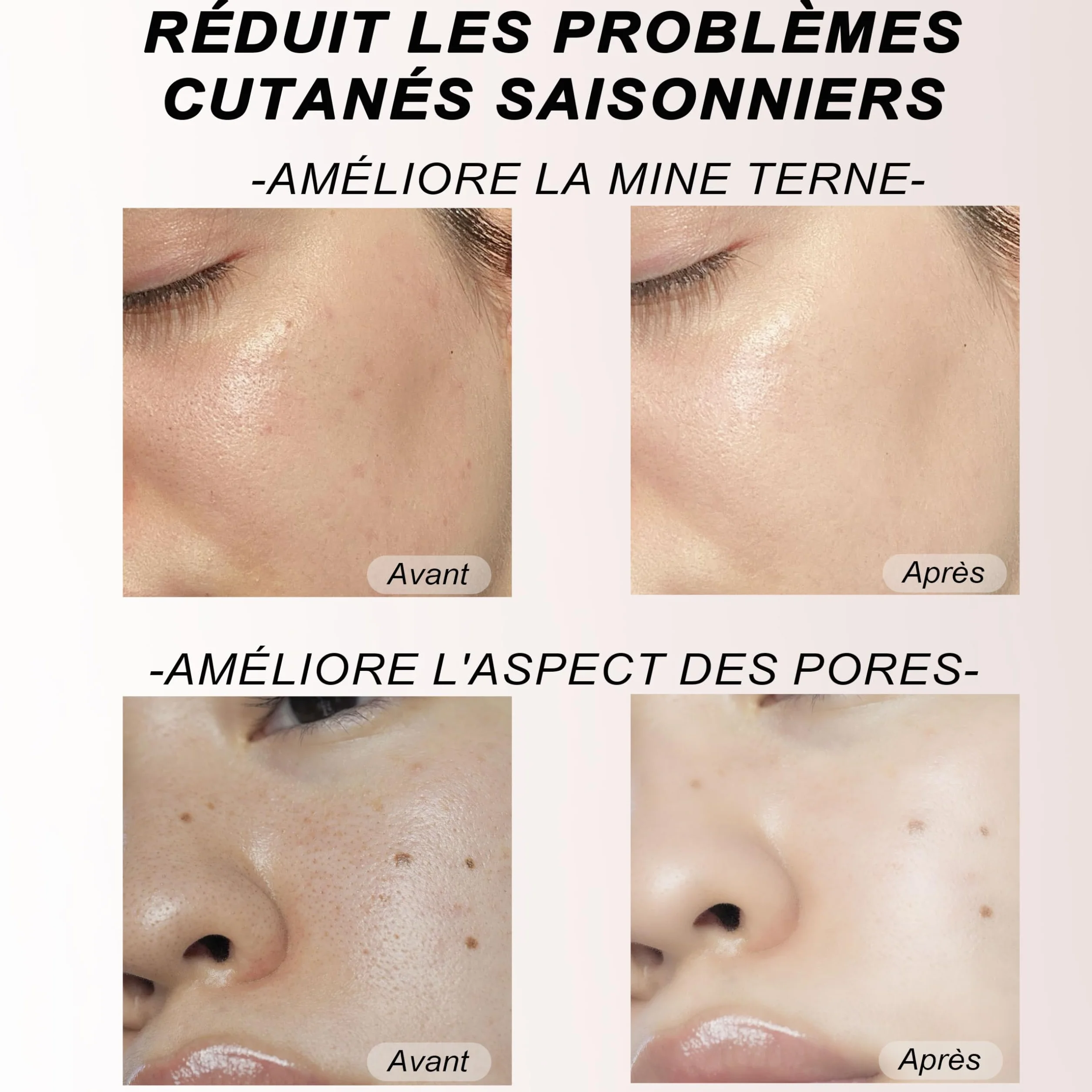 Masque visage en collagène 8 paquets, hydrogel hydratation apaisement soins peau