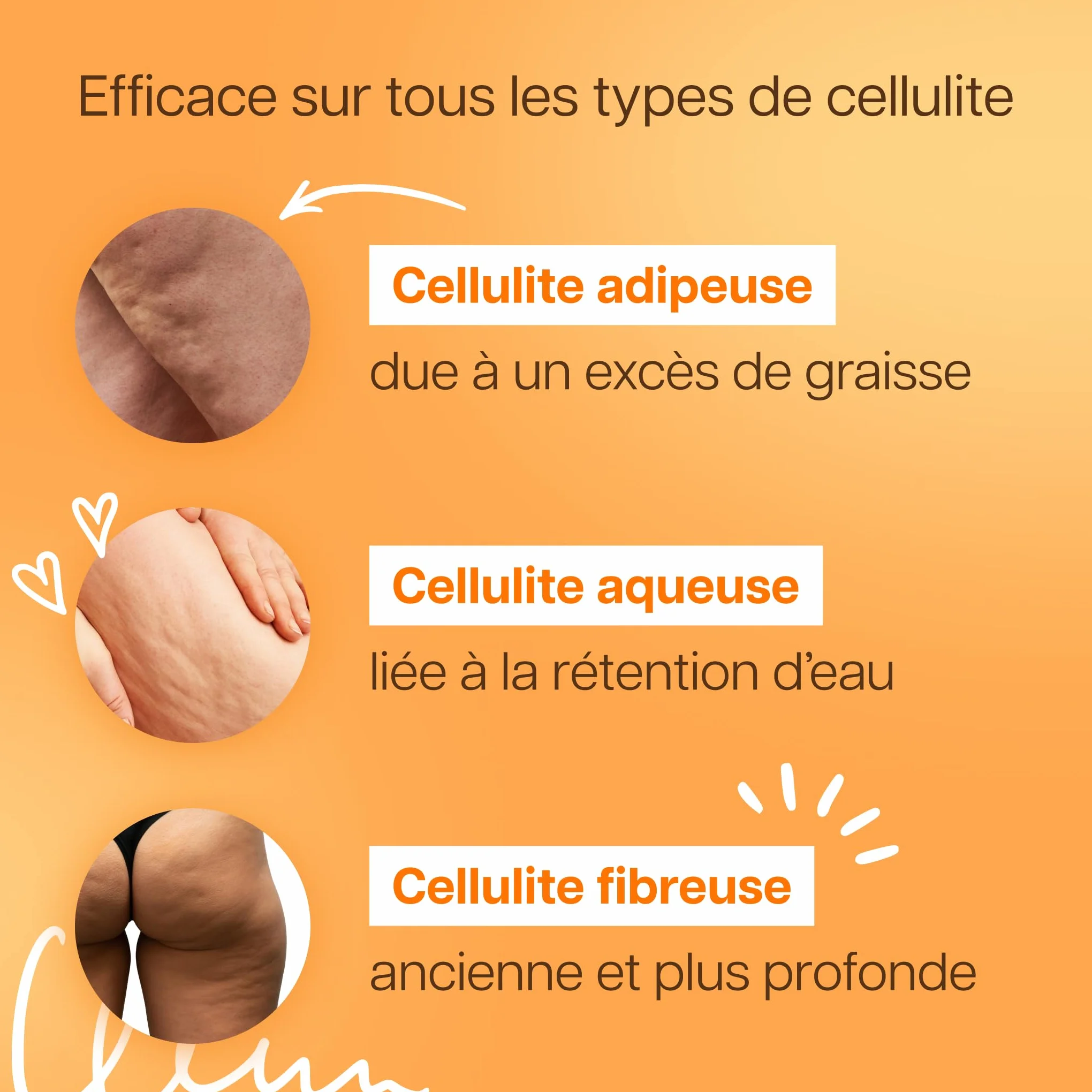 Huile Anti-Cellulite Naturelle 150 ml Massage Ventouse Palper-Rouler Huiles d'Amande Douce Tournesol 99% Ingrédients Naturels