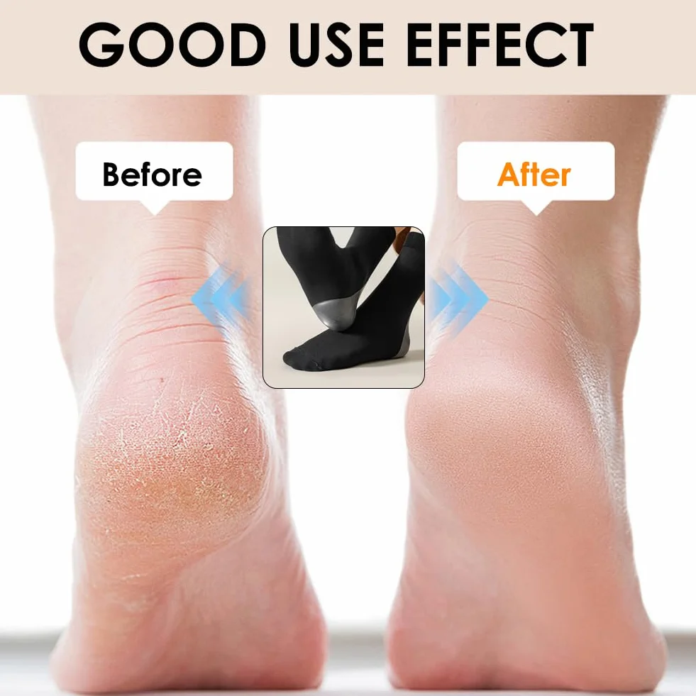 Chaussettes Hydratantes Pieds Secs 2 Paires en Silicone Soins Peau Fissurée Dure Sèche Jour et Nuit