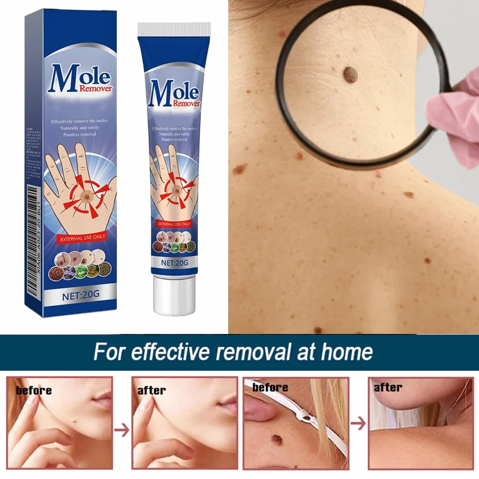 Crème Anti-Verrues et Anti-étiquettes Cutanées 20g
