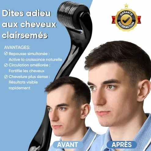 Dermaroller Microneedling 540 Micro-Aiguilles Titane Médical 0,5 mm Visage Repousse Cheveux Barbe Réduction Cicatrices Rides