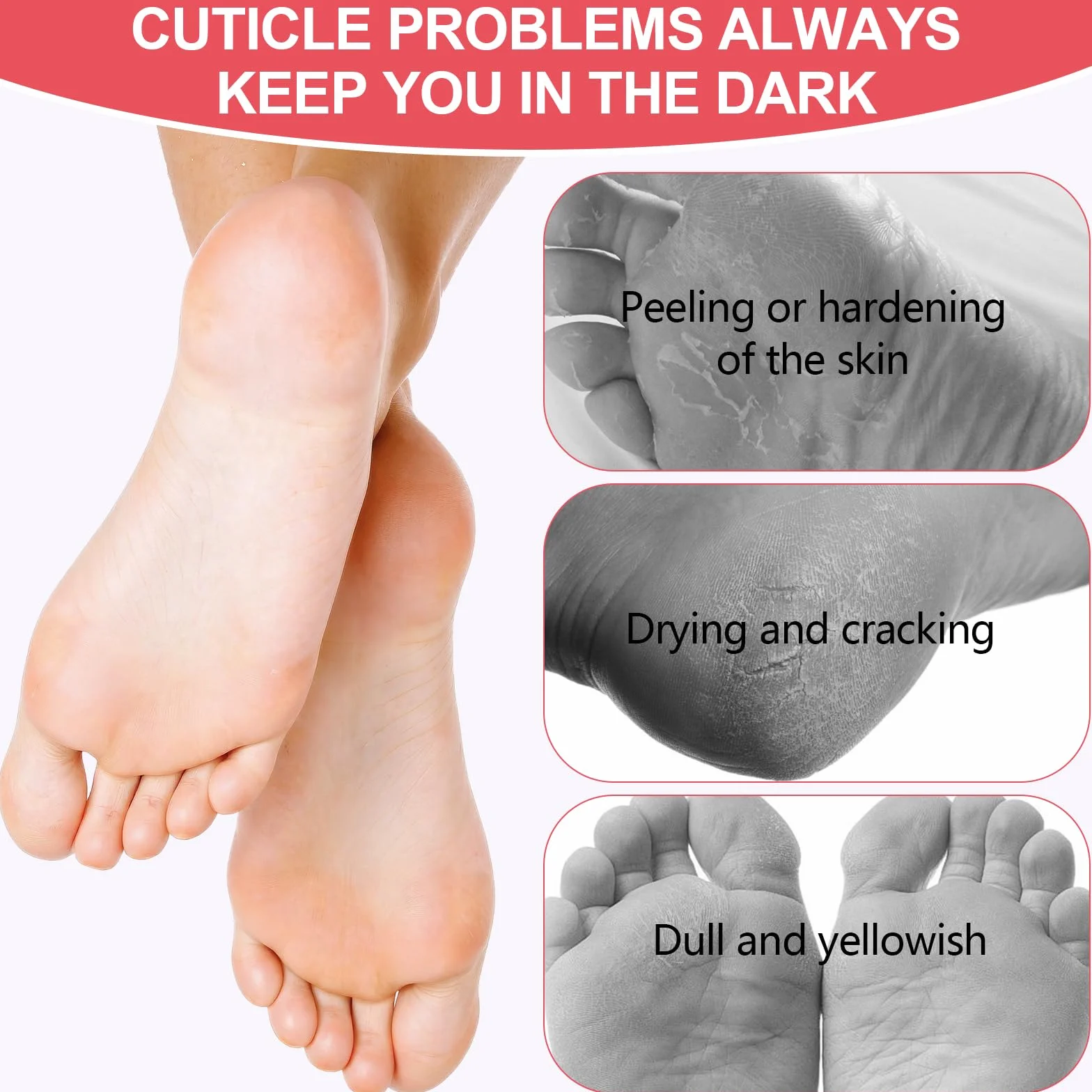 Masque Pied Peeling Pêche 3 Paires, Exfoliant Pieds Talons Peau Morte Sèche pour Pieds Doux