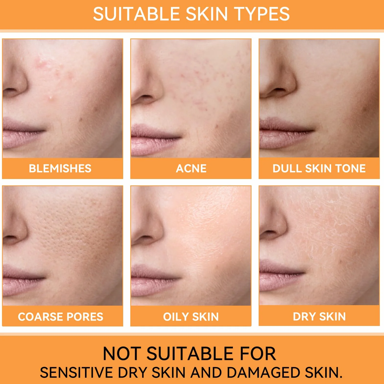 Acide Glycolique 7% Toning Solution Hydratant Imperfections Acné
