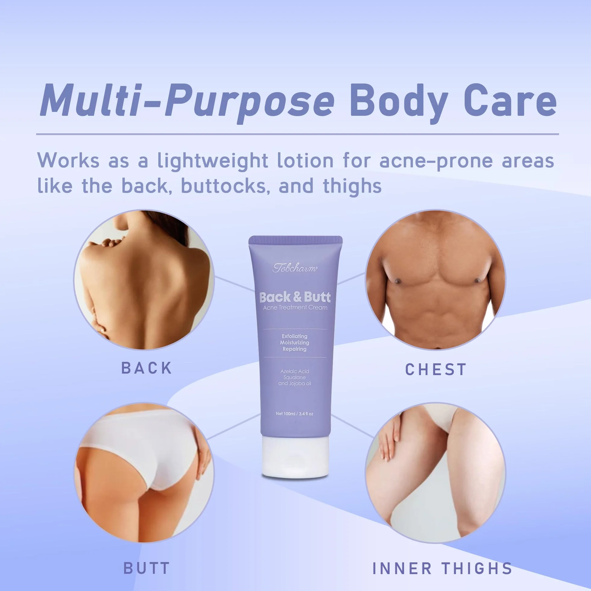 Crème Anti-Acné Tobcharm Acide Azélaïque Traitement Visage Boutons Fessiers Akne Hormonale