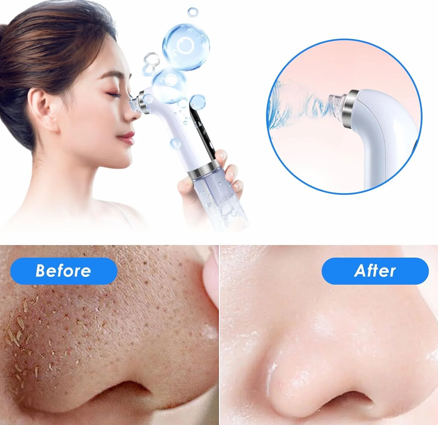 Aspirateur Points Noirs, Extracteur Points Noirs Visage, 4 Modes, 6 Sondes, 75 kPa Super puissance, Tire Comedon Points Noirs Anti Point Noir Nez Nettoyage des Pore Peau Soin Visage Blackhead Removal