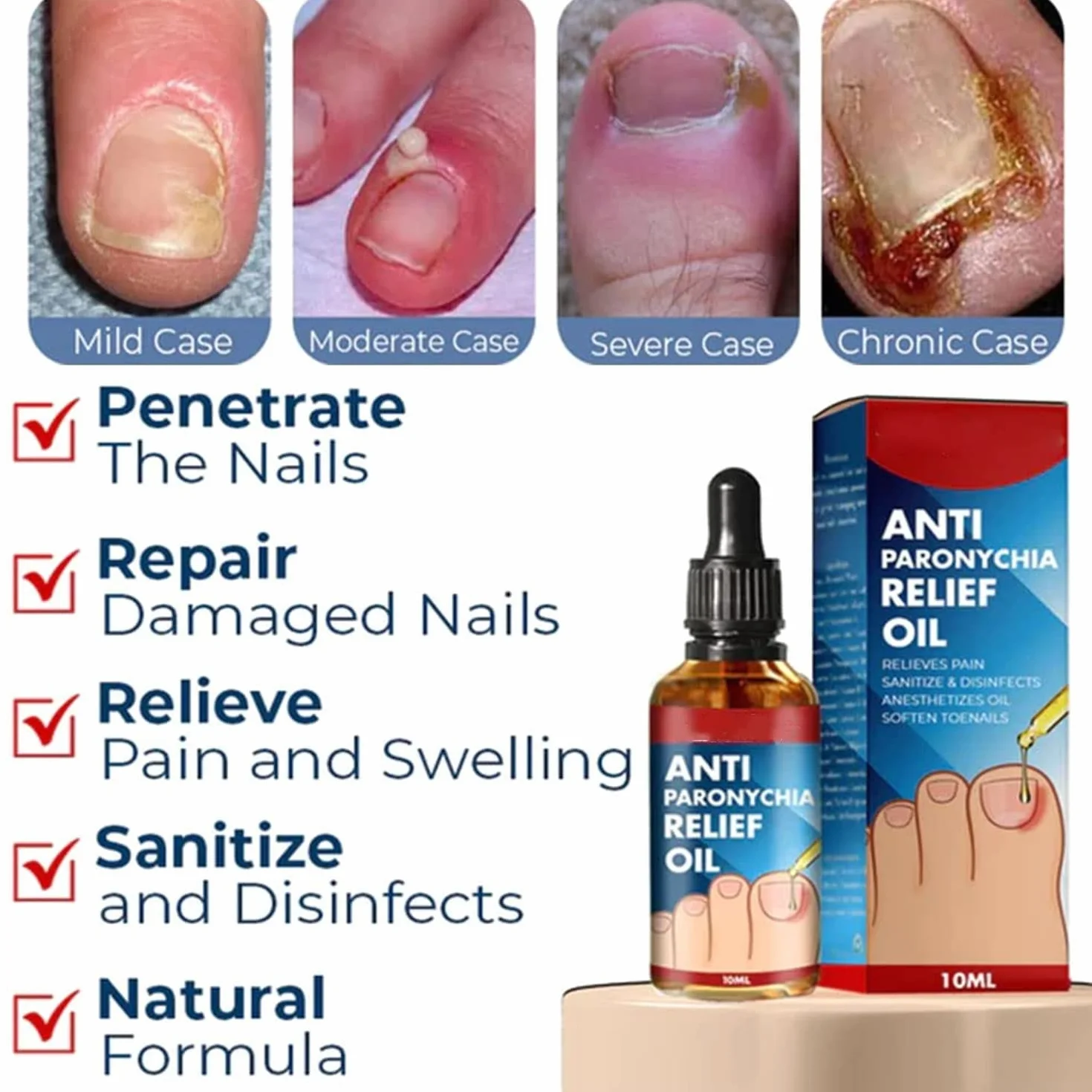 German Toenailplus Anti Paronychia Relief Oil, Paronychia Treatment for Toe and Fingernail Repair (2pcs)