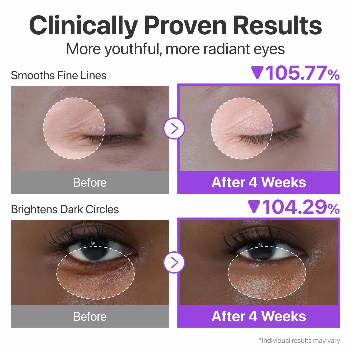 numbuzin No.9 Eye Cream NAD+ Retinol Volumetox Firming Wrinkles Dark Circles Puffy Undereye Treatment 0.33 fl oz