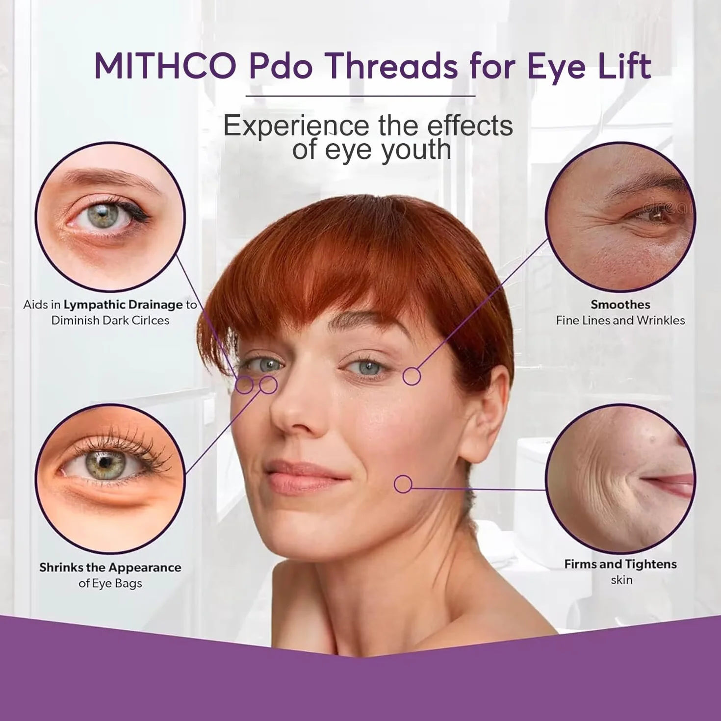 MITHCO Lot de 20 fils de lifting pour les yeux anti-rides 30 g 25 mm
