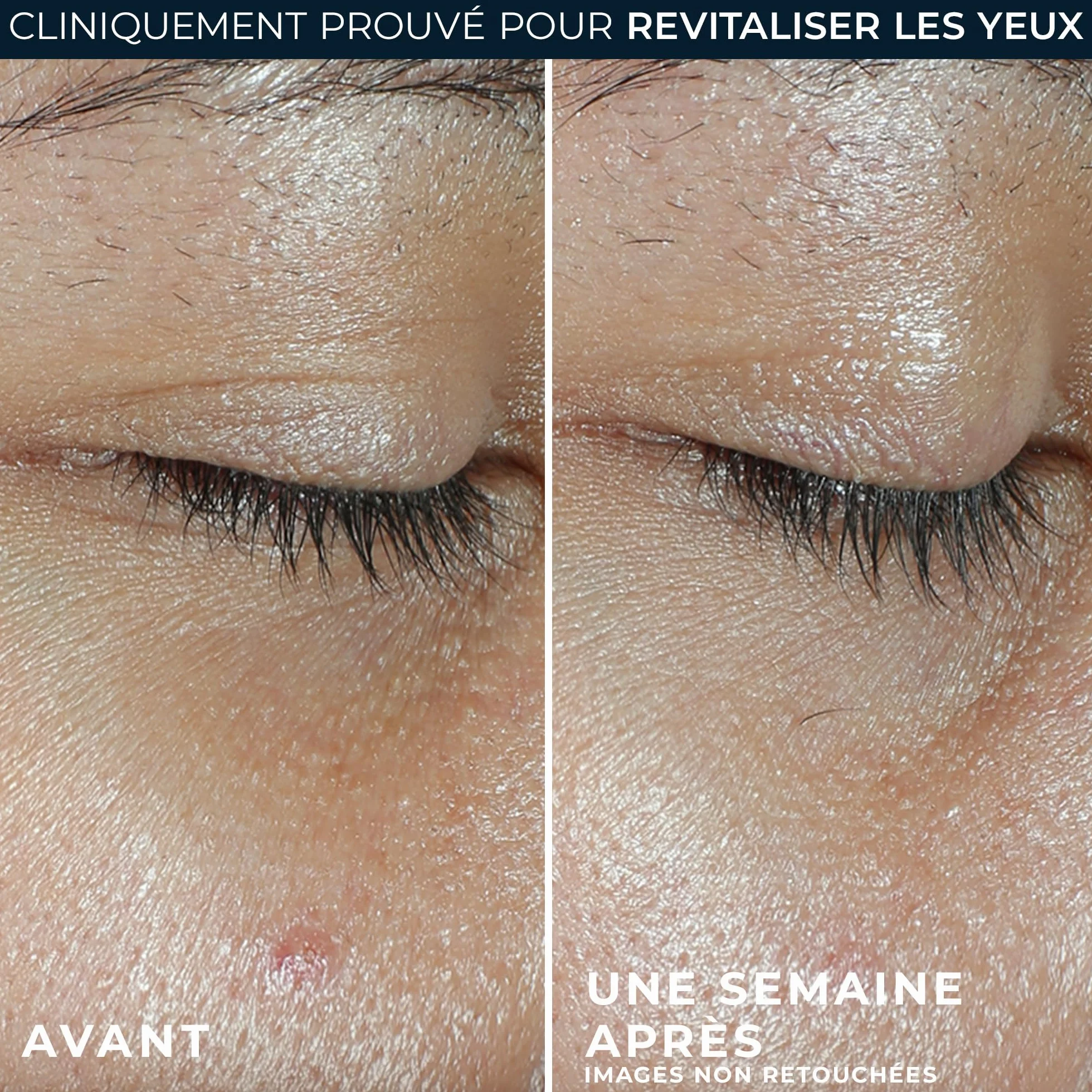 RoC Multi Correxion Renouveau + Eclat Baume pour les yeux Vitamine C Hypoallergénique 4 g