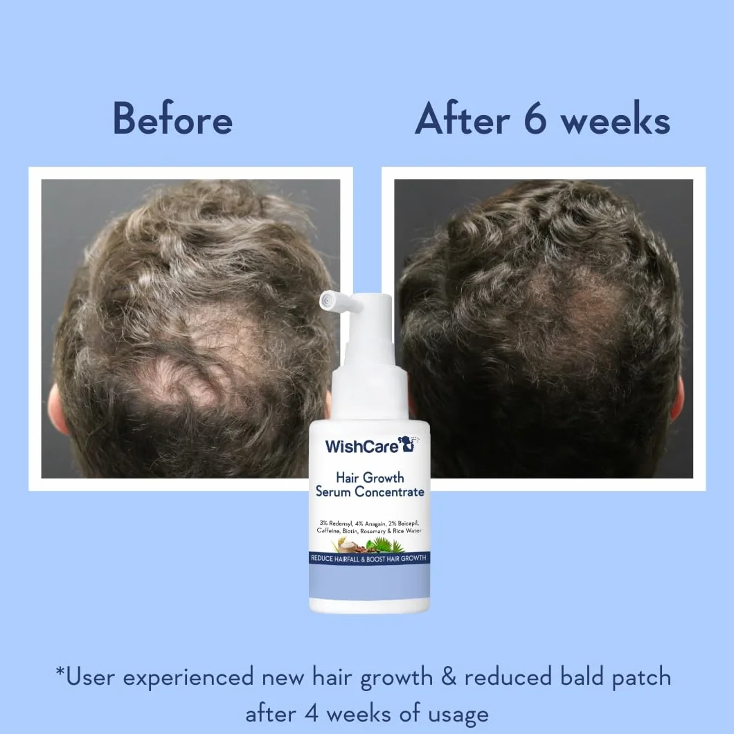 Sérum de croissance des cheveux WishCare avec romarin, Redensyl, Anagain, Baicapil, caféine, biotine