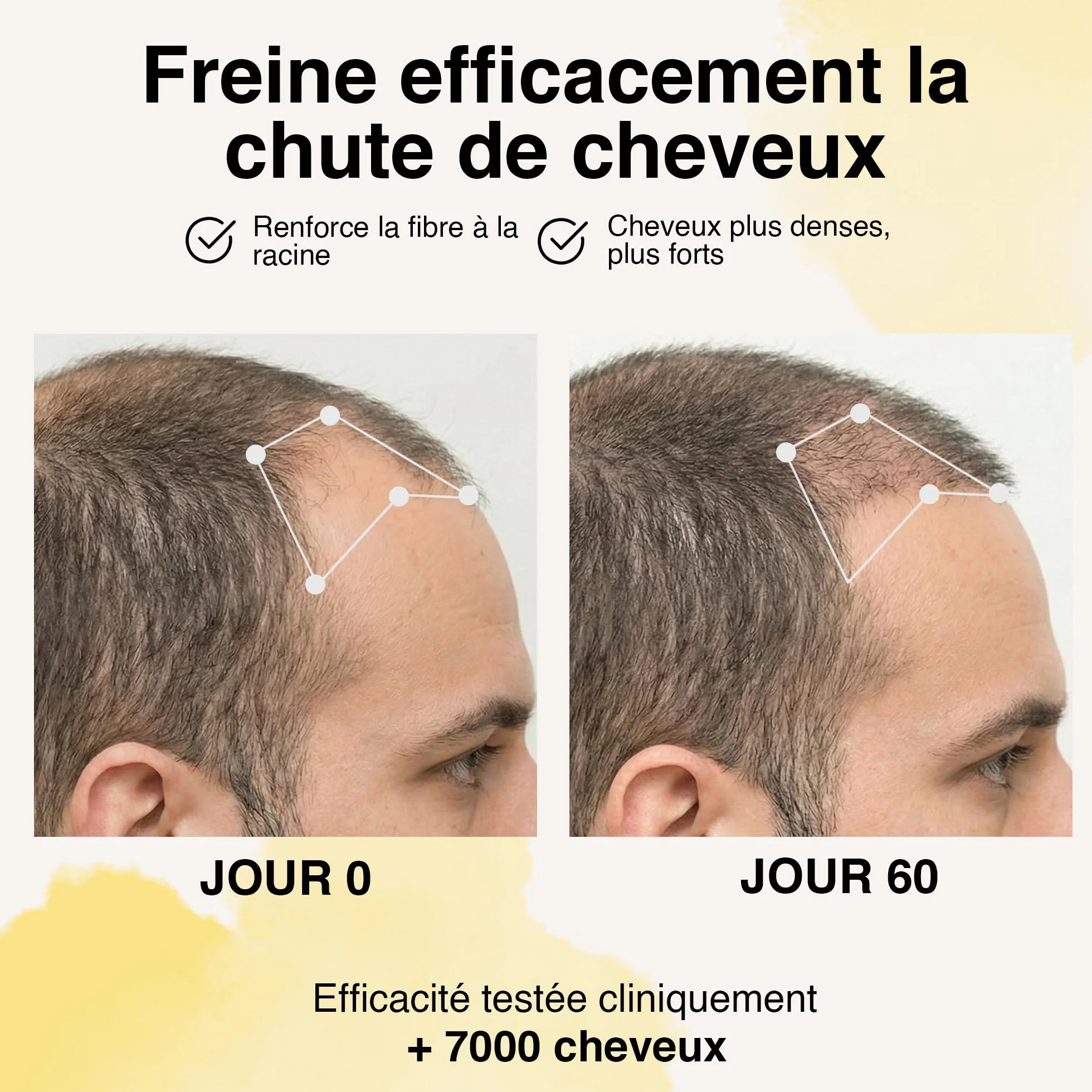 Juste Paris Serum pousse cheveux Bio - Anti chute - Croissance capillaire - Fabriqué en France
