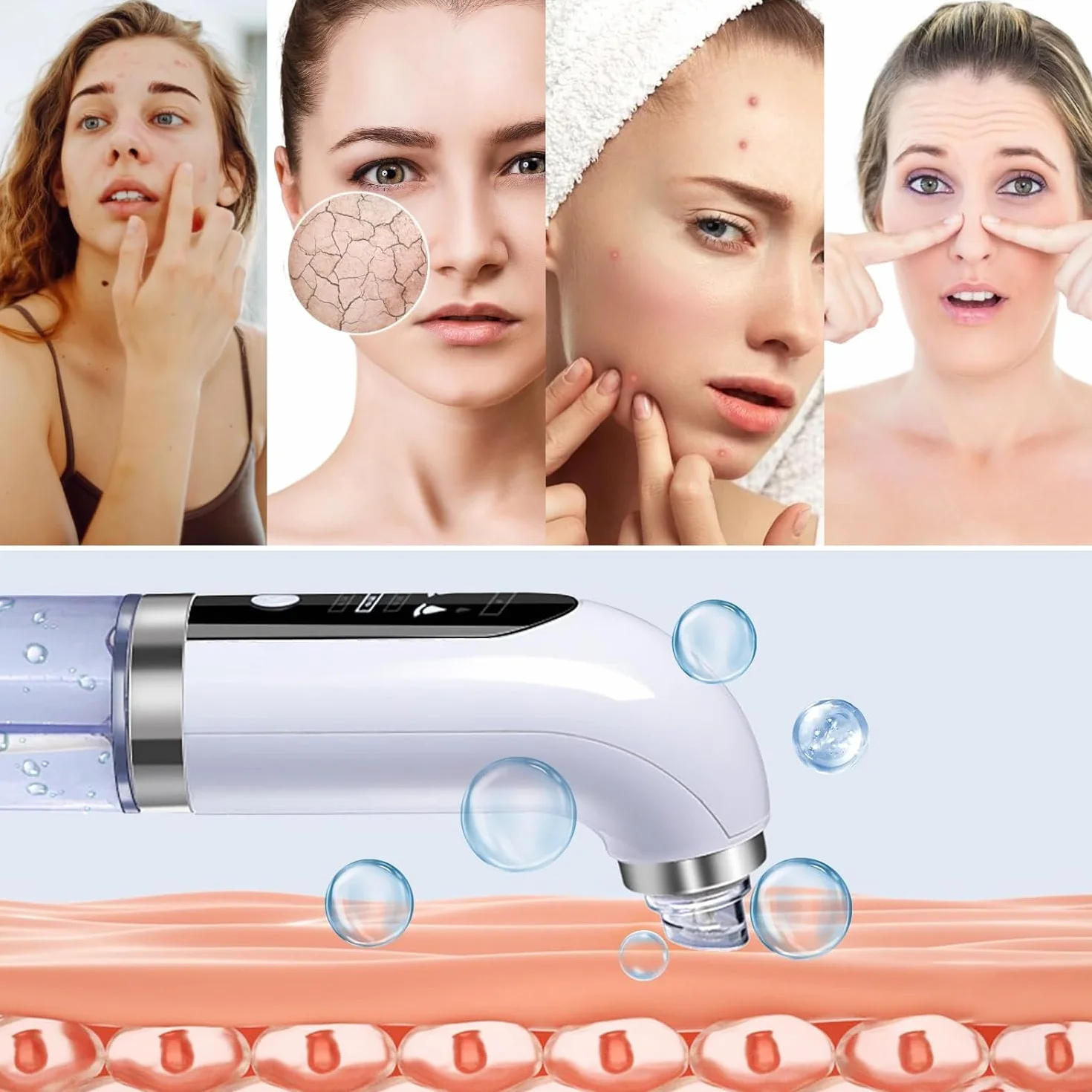Aspirateur Points Noirs, Extracteur Points Noirs Visage, 4 Modes, 6 Sondes, 75 kPa Super puissance, Tire Comedon Points Noirs Anti Point Noir Nez Nettoyage des Pore Peau Soin Visage Blackhead Removal