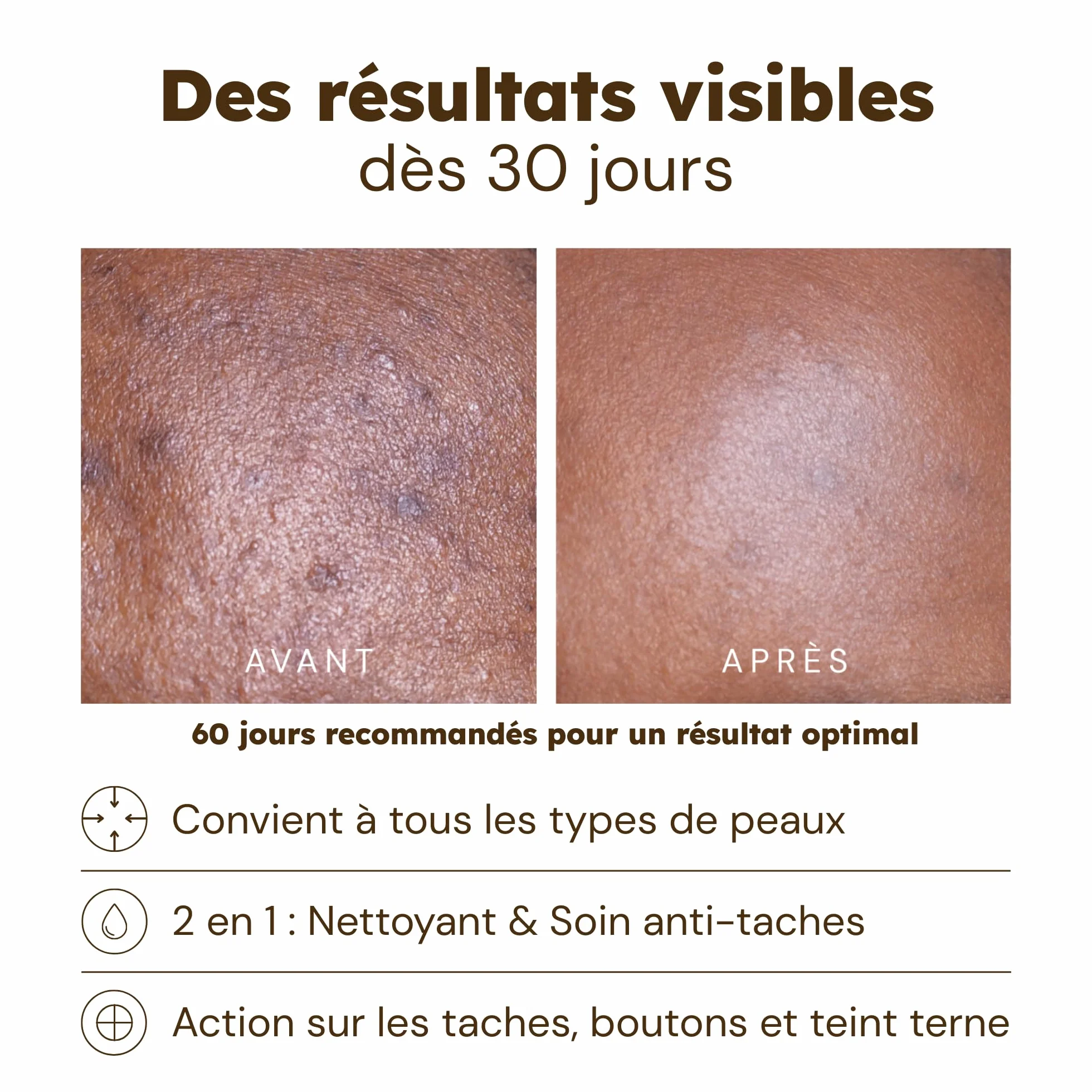 Cotons anti-imperfections visage & corps Curcuma Vitamine C Niacinamide 30 cotons